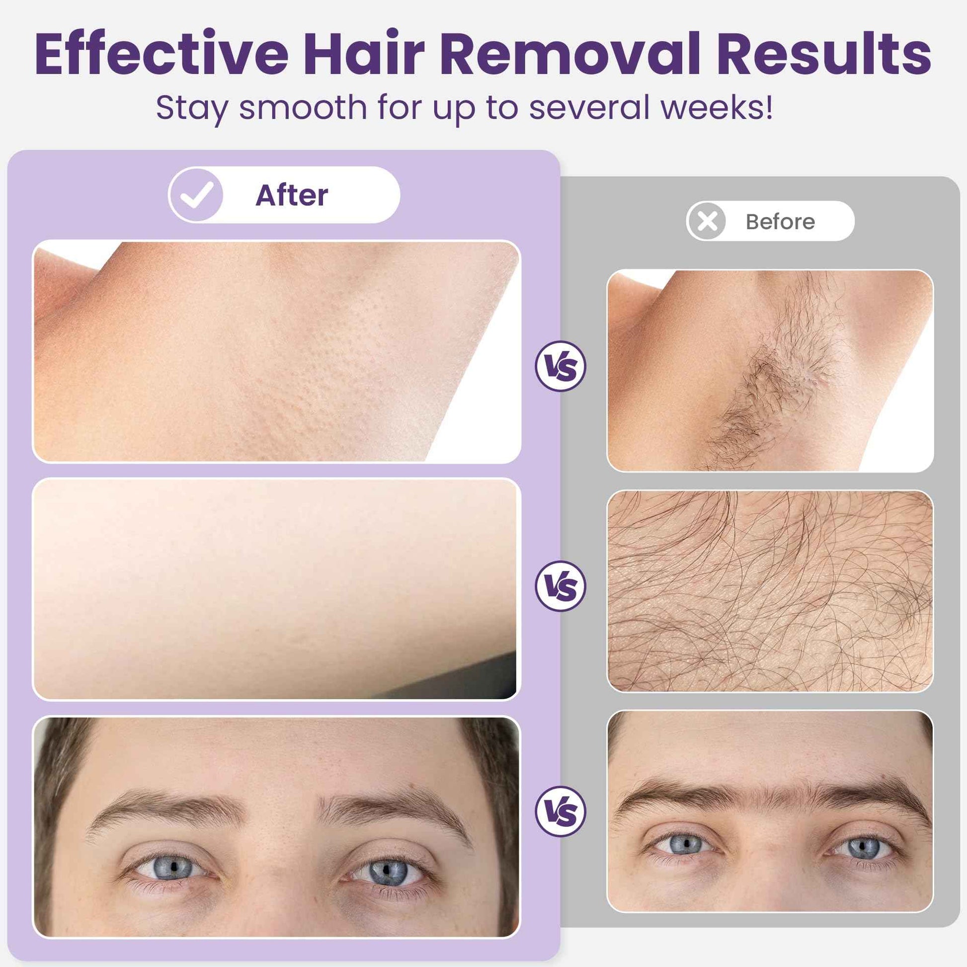 Sunvivi Waxing Kit, Brazilian Wax Warmer for Hair Removal with 5 Bag Hard Wax Beads, Digital Display Melt Warmer Kit for Women Men Full Body, Legs, Face, Bikini,Sensitive skin, Pink