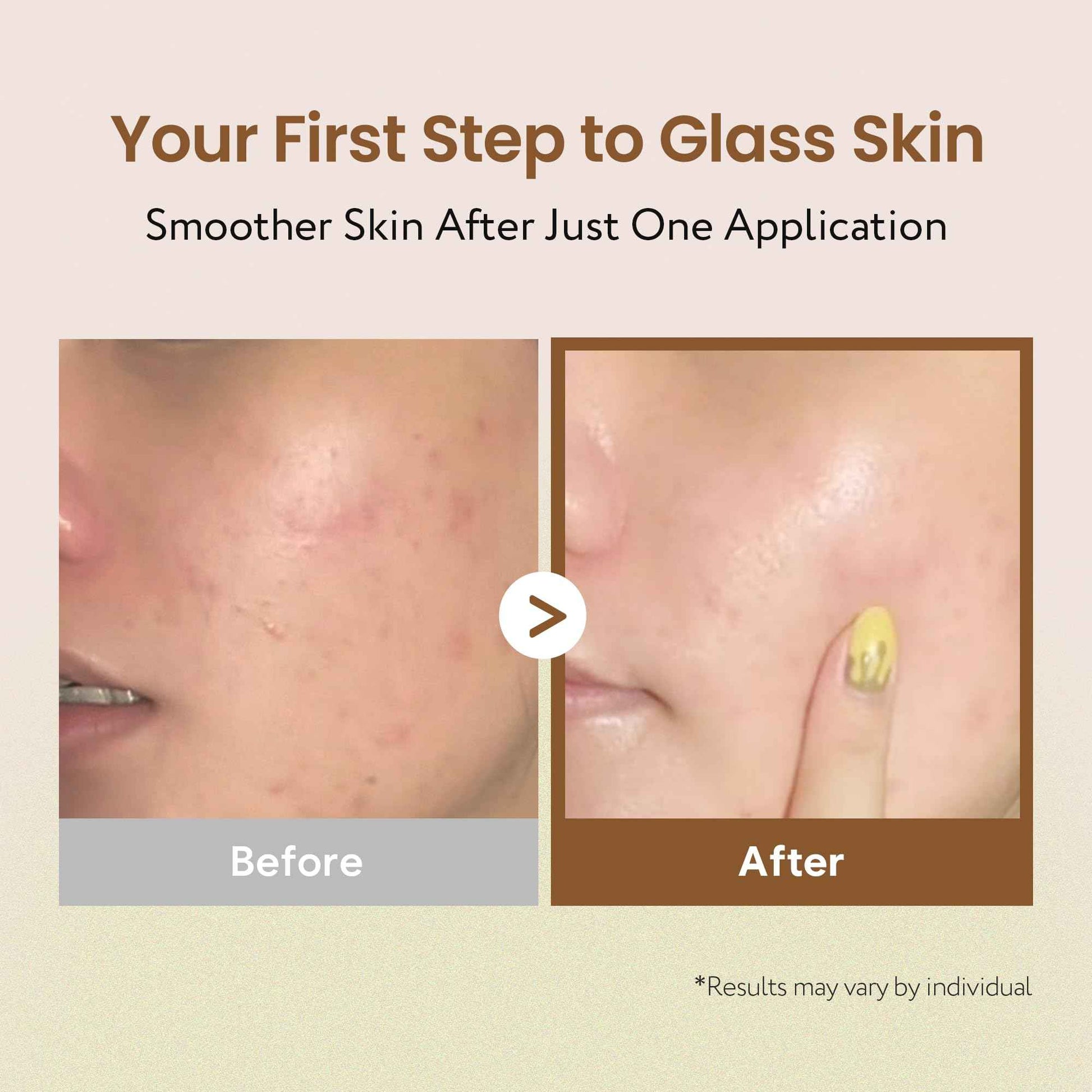 SOONDING Coconut Rice Milk Toner | Calming Hydration, Smooth Skin Texture and Strengthen Skin Barrier with Rice, Panthenol, Ceramide, AHA | Fragrance-Free, Korean Skin Care (150ml/ 5.07 fl oz)