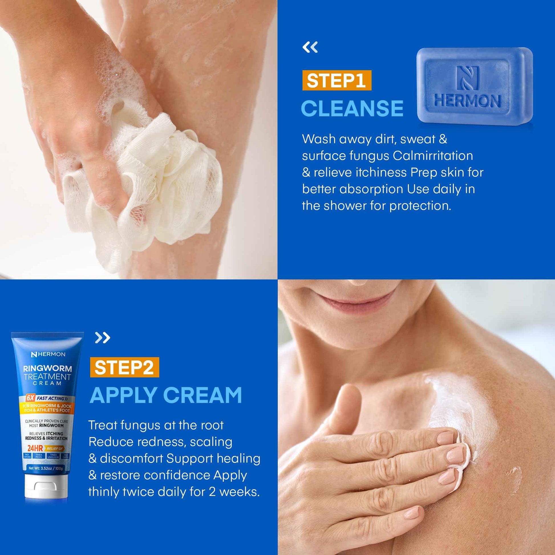 Hermon Ringworm Treatment Anti-fungal Kit - RingWorm Treatment for Humans 3.52 oz cream 4 oz soap bar for Ringworm, Athlete's Foot, Jock Itch, Eczema, Tinea - for Adults and Kids