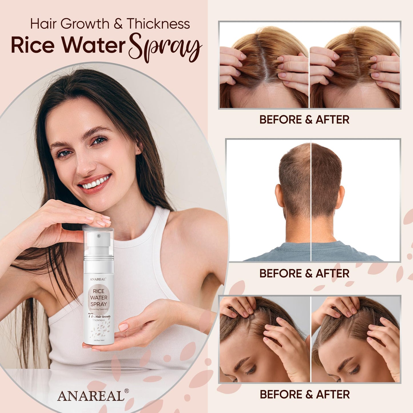 Rice Water for Hair Growth, Hair Growth Serum Women, Rice Water, Rice Water Spray, Rice Water for Hair, Rice Water Spray that can be used with Rice Water Shampoo and Conditioner, 60ml