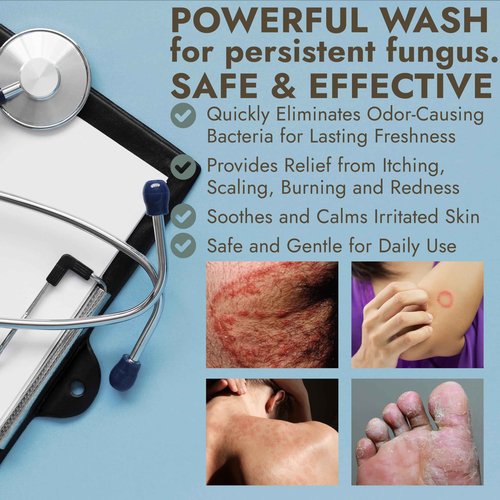 Antibacterial Body Wash | Antifungal Soap for Men & Women | Kills 99.9% of Germs & Bacteria | Helps with Back Acne, Body Odor, Jock Itch & Skin Irritation | Manuka Honey & Charcoal, 16 fl oz