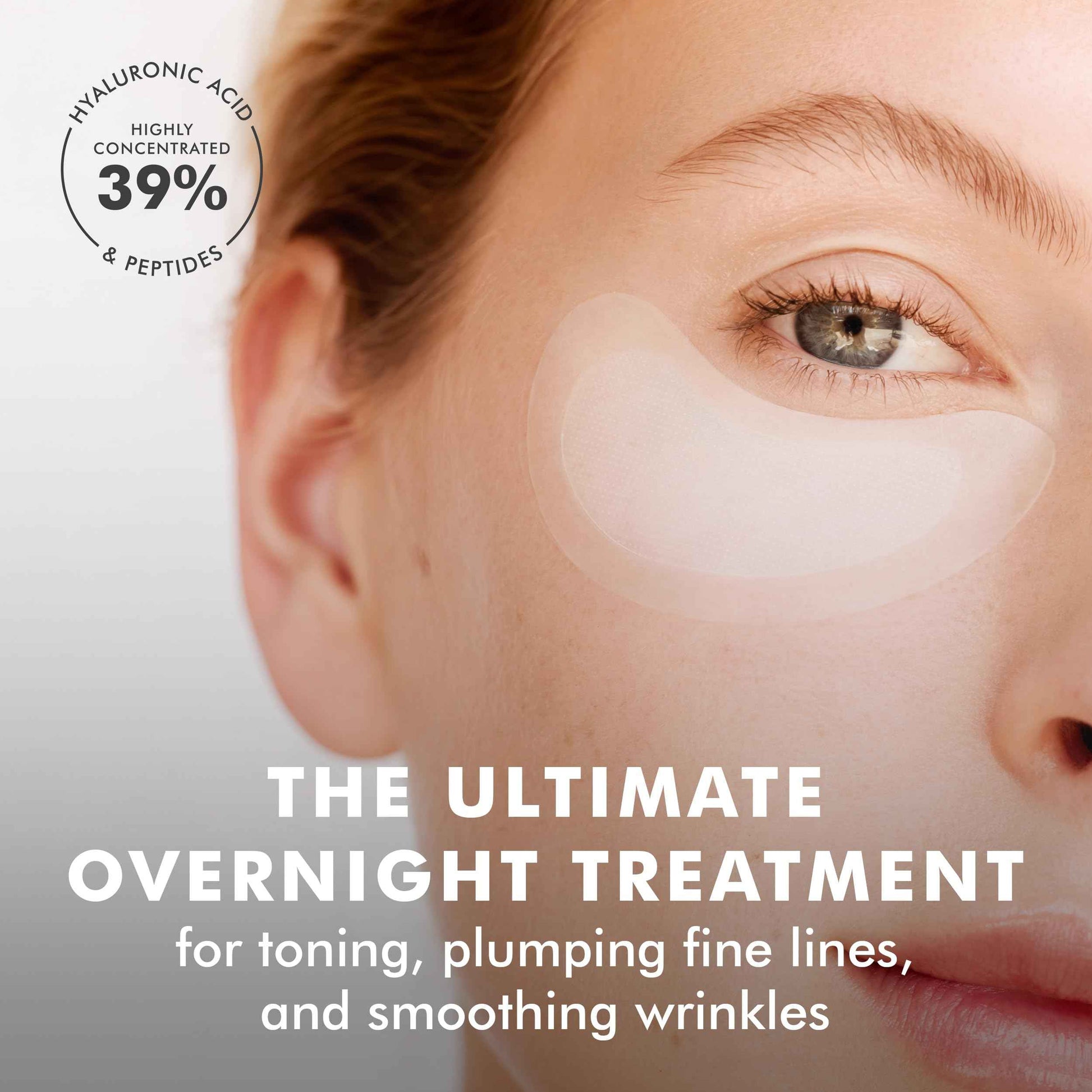 skyn ICELAND Dissolving Microneedle Under Eye Patches with 39% Hyaluronic Acid and Peptides, No Slip Overnight Eye Mask for Fine Lines, Wrinkles and Firming, Vegan, All Skin Types, 3 Pairs