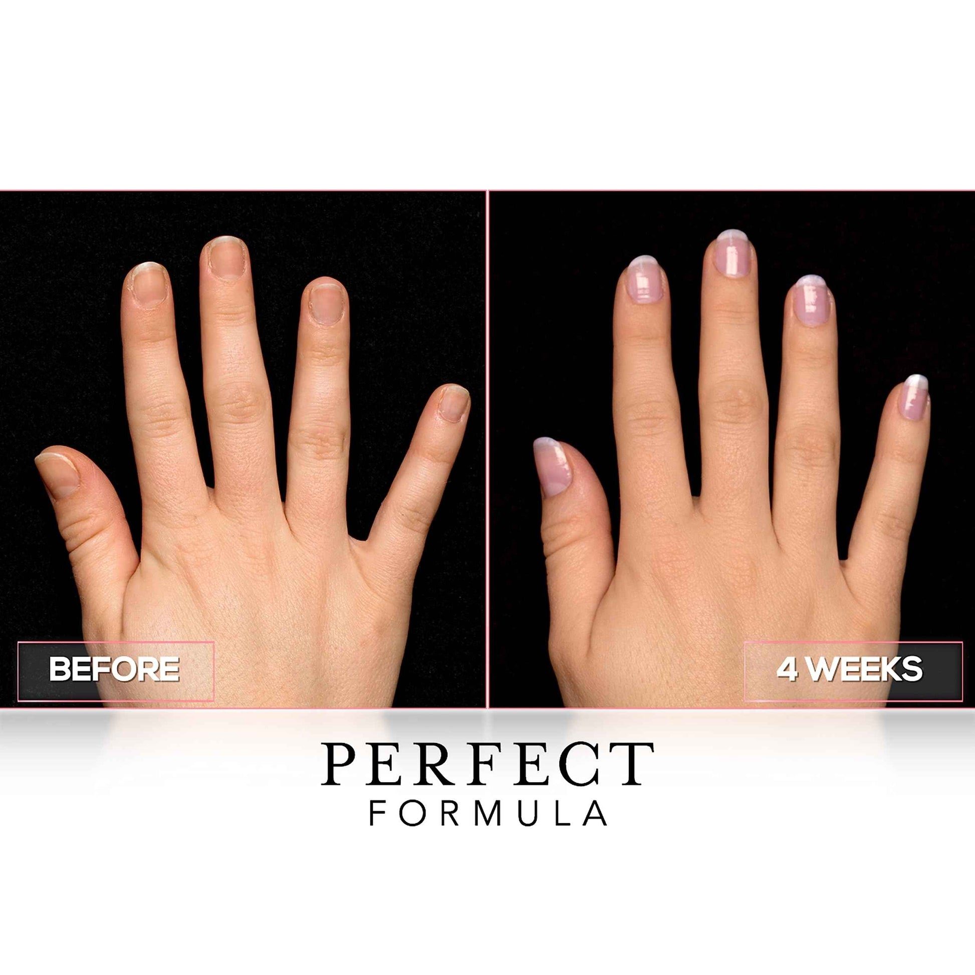 Perfect Formula Repair Coat - Nail Strengthener, Keratin Treatment, Nail Repair for Damaged Nails - Made In The USA .60 fl oz.