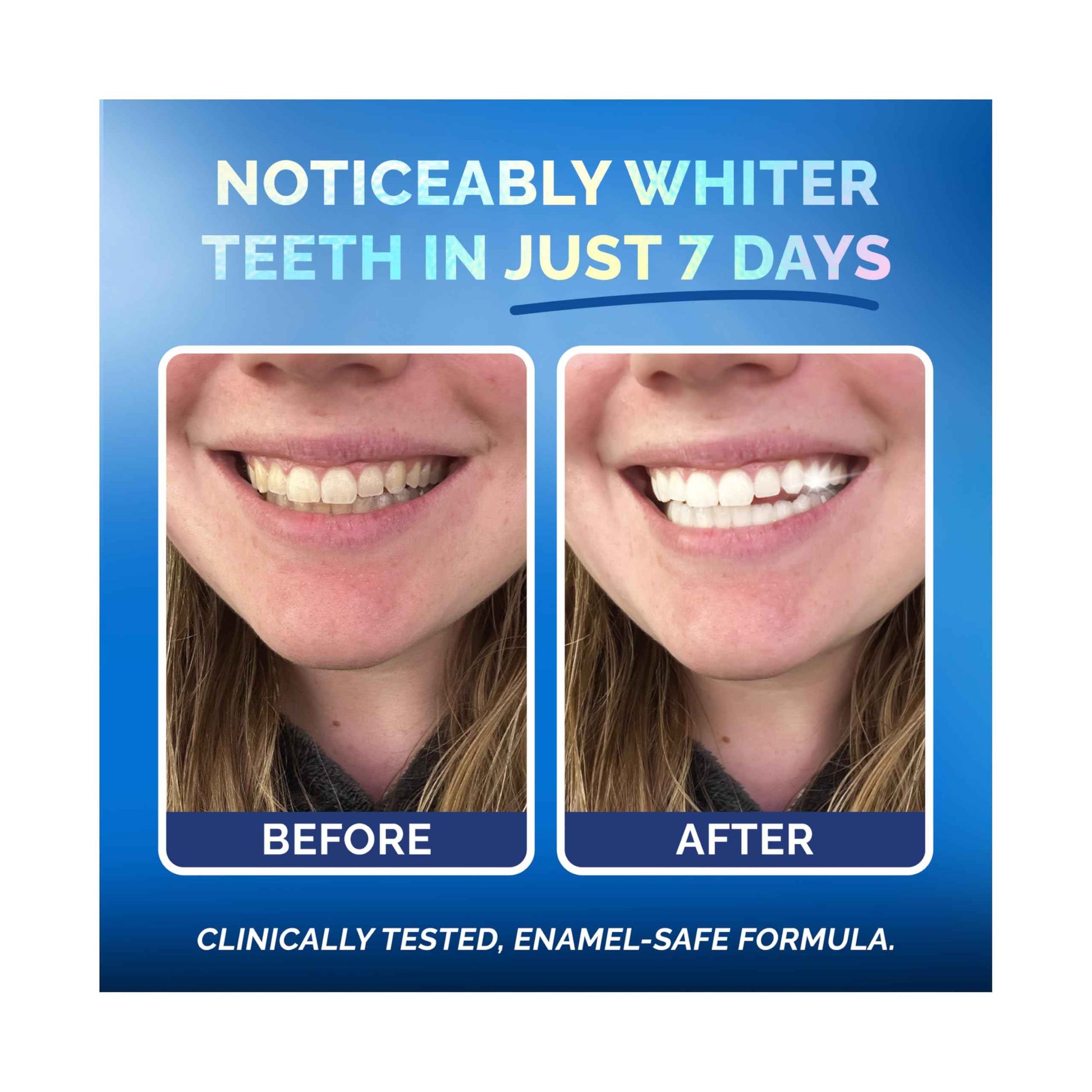 Whitening Strips for Sensitive Teeth 28 Treatments, Coconut – Enamel Safe, Peroxide-Free Coconut Teeth Whitening Strips with Natural Enzymes – Gentle White Stips for Sensitive Gums & Daily Oral Care