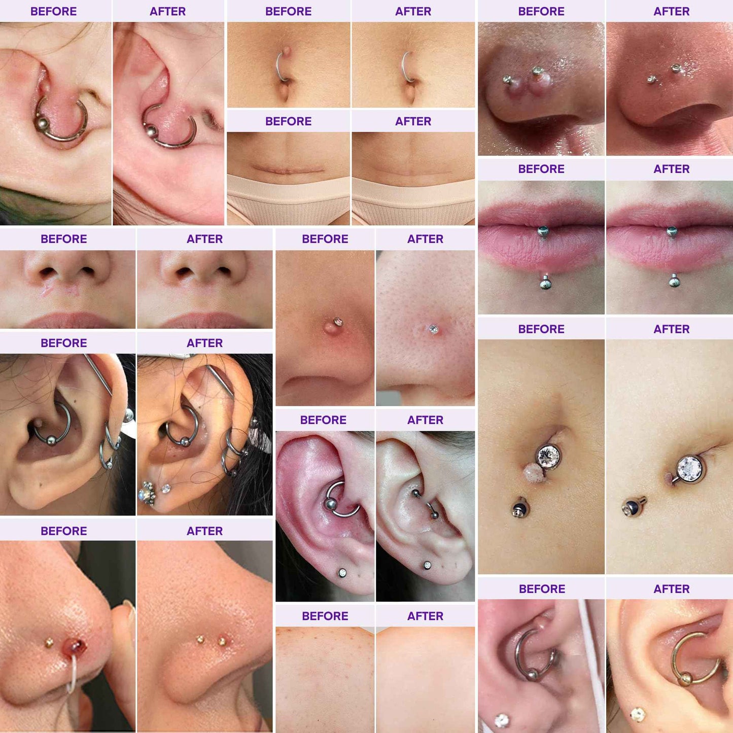 Piercing & Keloid Bump Solution Oil & Gel Kit, Piercing Aftercare Treatment Piercing Bump Solution Aftercare Oil (30 mL) + Keloid Bump Removal Gel (20 g) (0.71 oz (20g))