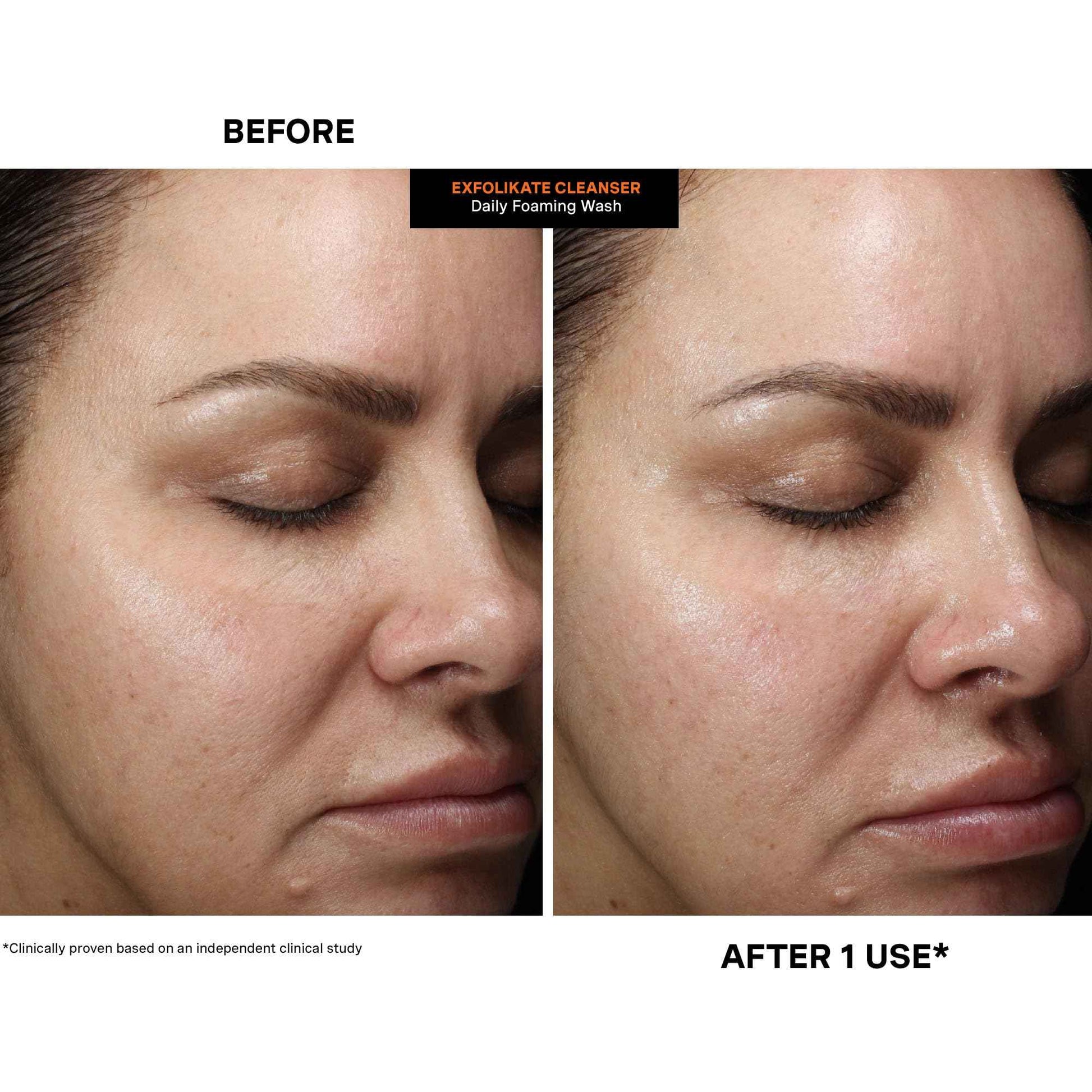 Kate Somerville ExfoliKate Cleanser – Daily Exfoliating Foaming Face Wash, Clinically Formulated Glycolic Acid and Lactic Acid Gentle Facial Scrub, 4 Fl Oz