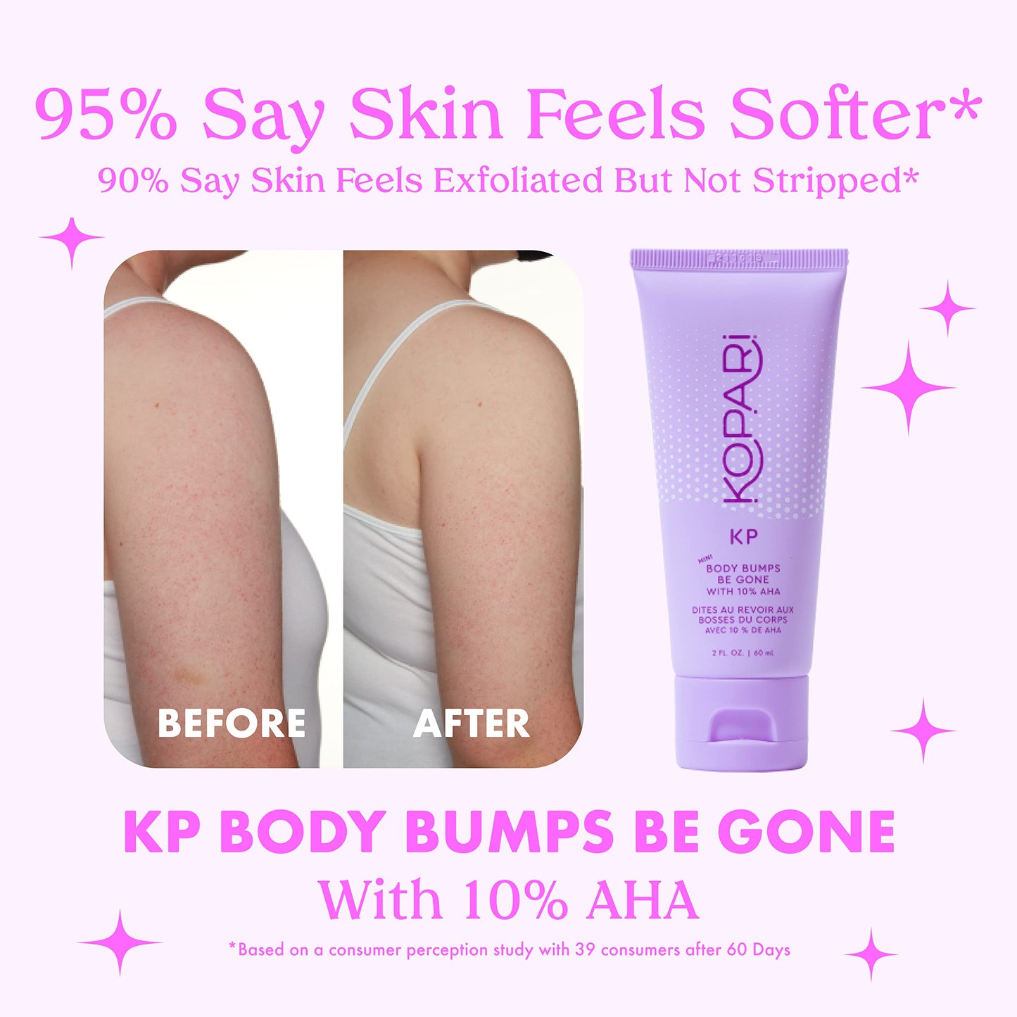 Kopari KP Body Bumps Be Gone Exfoliating Body Scrub with 10% AHA, to Smooth Skin, Reduce Bumps, Decongest Pores, Clarifying, Gently Exfoliate & Wash | 8.45 fl oz Tube