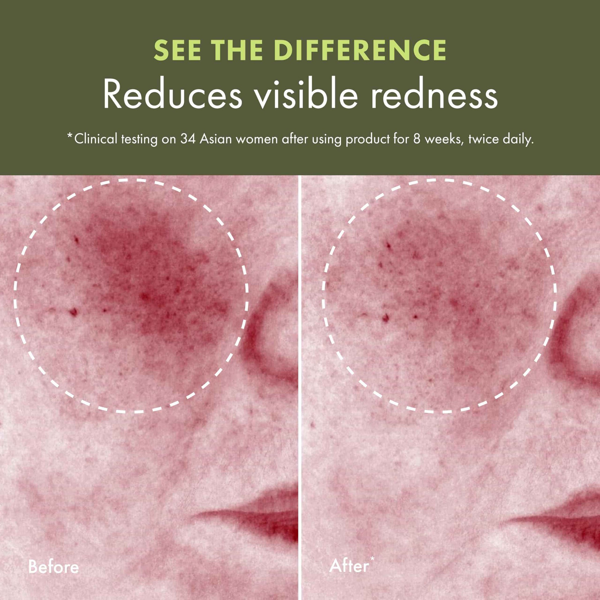 Origins Mega-Mushroom Soothing Treatment Lotion | Great for Sensitive Skin | With Reishi Mushroom | Travel Size, 3.4 Fl Oz