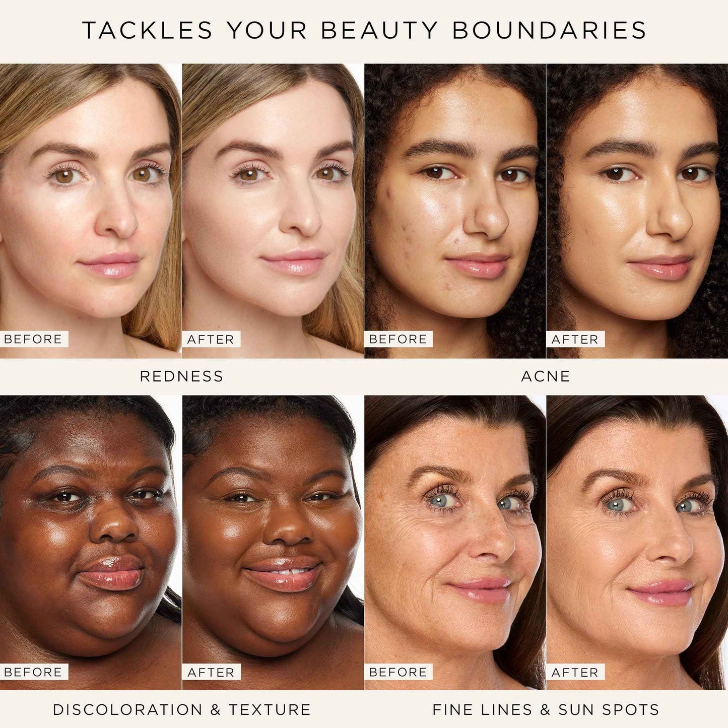 tarte shape tape radiant concealer – Medium-Coverage, Radiant Finish for Under Eye Concealer for Dark Circles, Fine Lines, Redness & Discoloration, Hydrating, Vegan, Cruelty Free