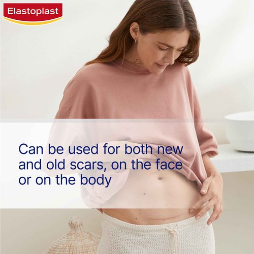 Elastoplast Scar Reducer Plasters (21 Pieces), Quick and Convenient Scar Cover Up Treatment, Scar Sheets to Reduce Visbility of Scars, Scar Plaster Pack for Quick Results