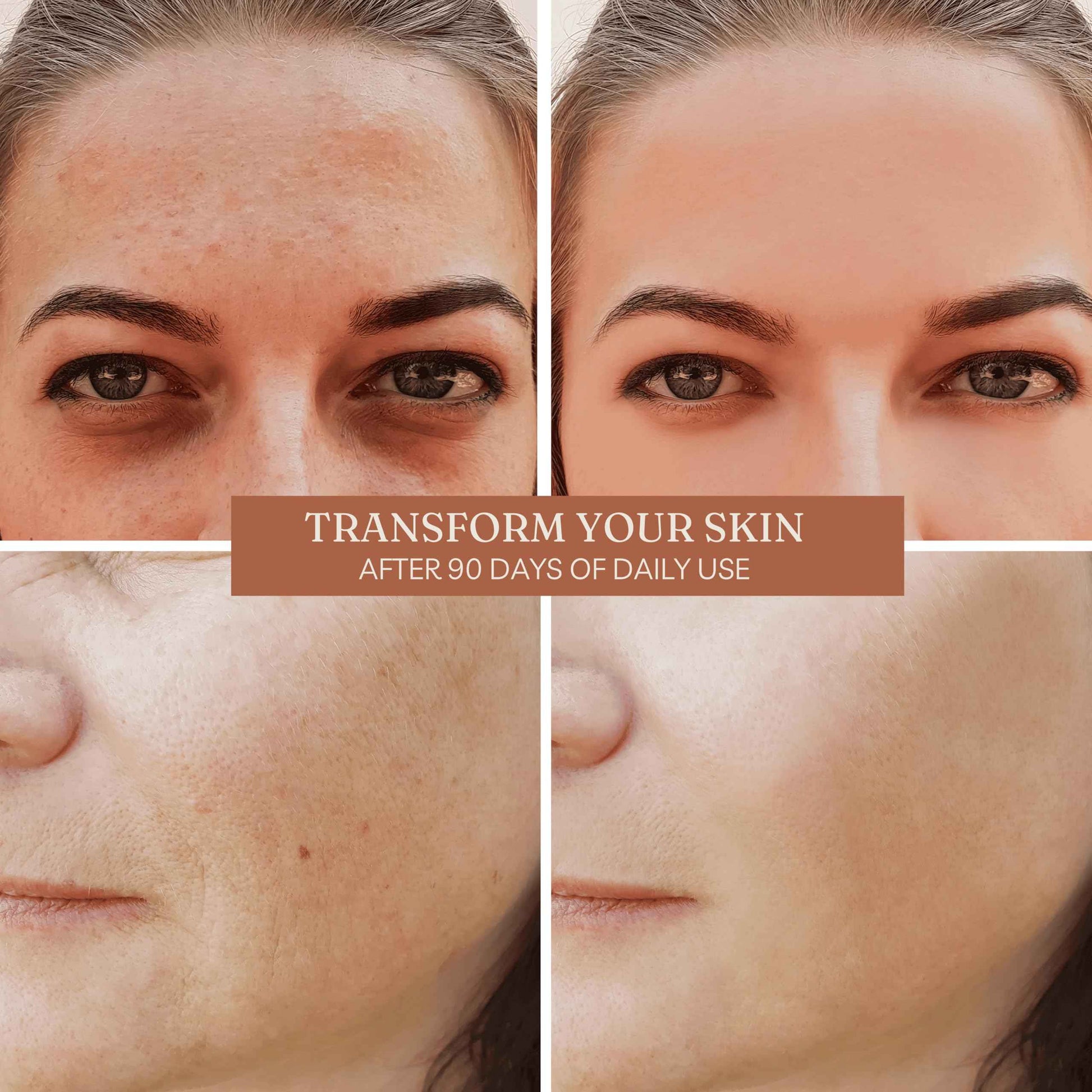 Offernova Organic Rosa de Mosqueta Oil- USDA Certified Rosehip Seed Oil Pure Cold Pressed, Repairs & Brightens Skin - Gua Sha Massage, Face, for All Skin Types - Aceite Facial 1OZ