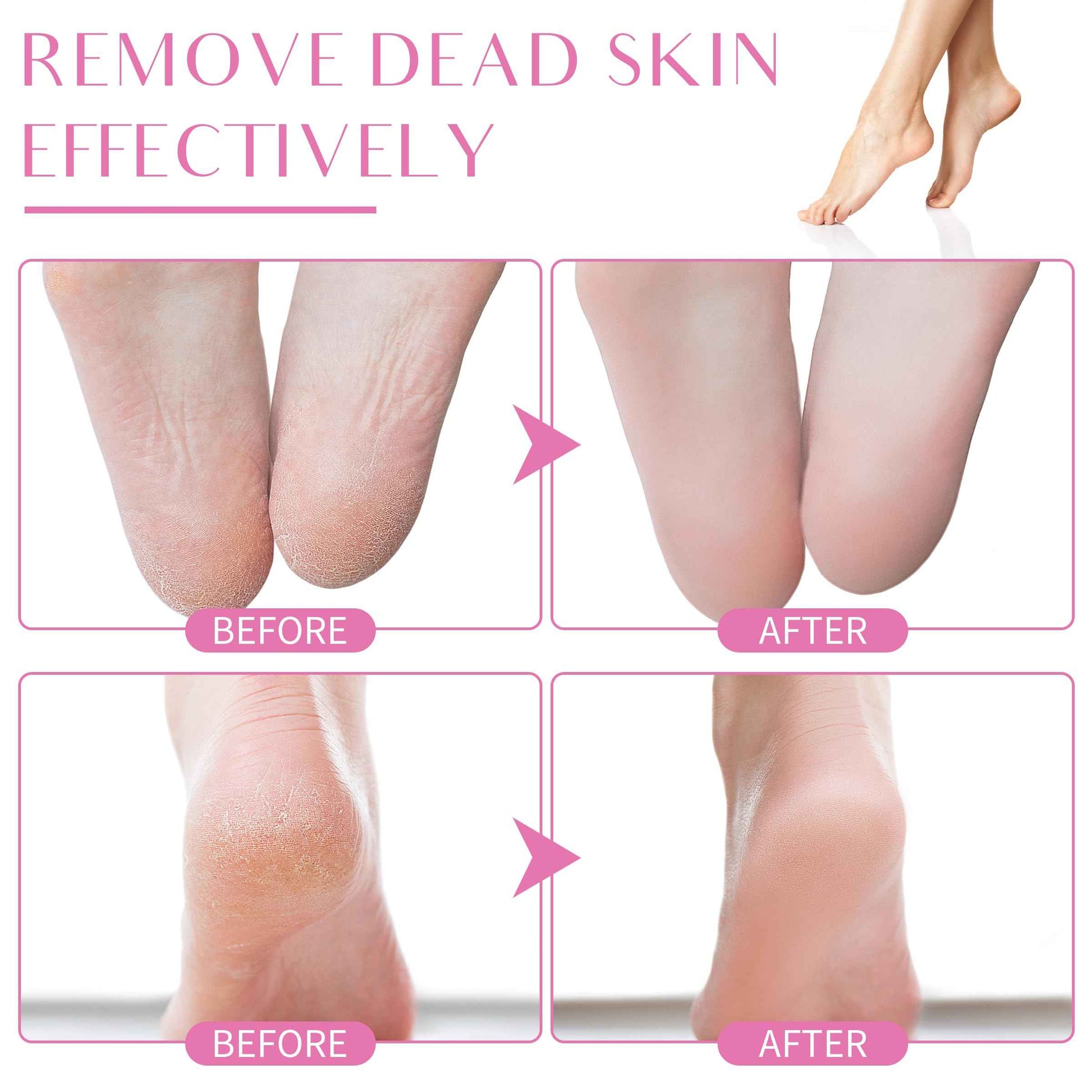 Electric Foot Callus Remover, Electric Foot Filer with 60 Pcs Replacement Sandpaper, Self-Adhesive Foot Sander with 360℃ Rotation, Aluminum Shell, Large Filing Area, and Adjustable Speed Controller