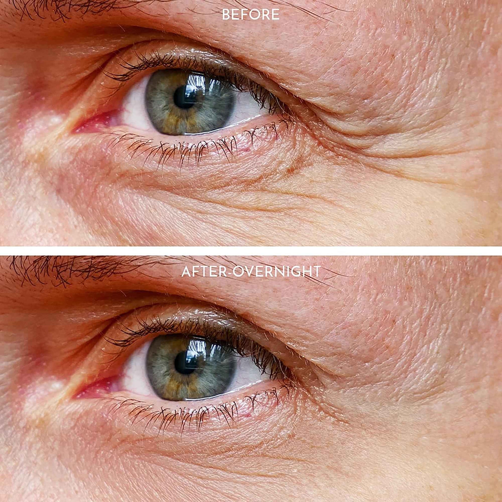 Truly Clear 20X Reusable Expression Line Smoothing, Medical-Grade Silicone for Overnight Wrinkle Reduction & Anti-Aging Hydration, Beautify Brow Lift Forehead Anti-Wrinkle Patch