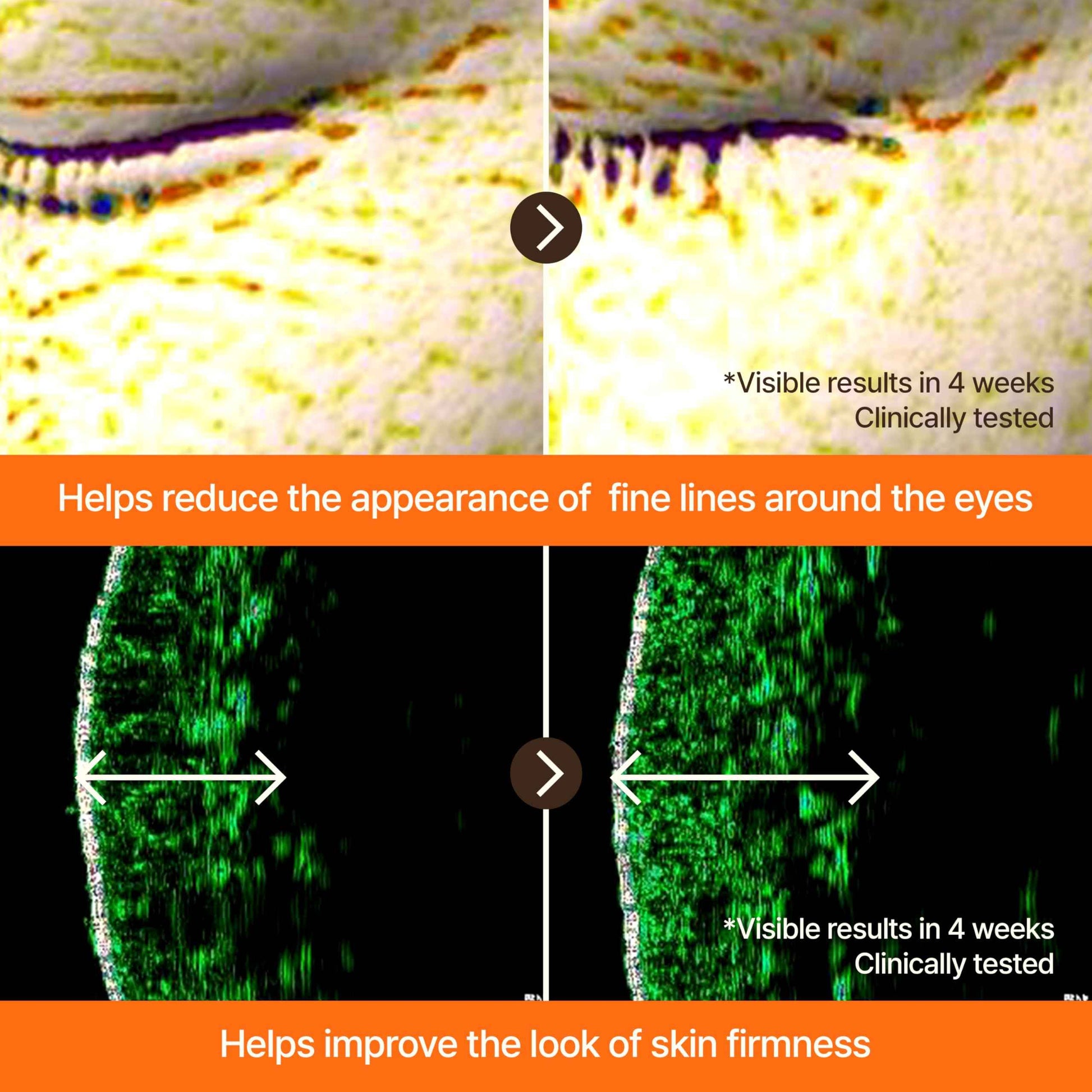 GOODAL Black Carrot VITA-A Retinal Intense Serum 8.0, Wrinkle Retinol Plumping Ampoule, Dark Spot Correcting Glow Serum, Pore Minimizing & Tightening, for Sensitive Skin, Korean Skincare, 0.68 Fl Oz