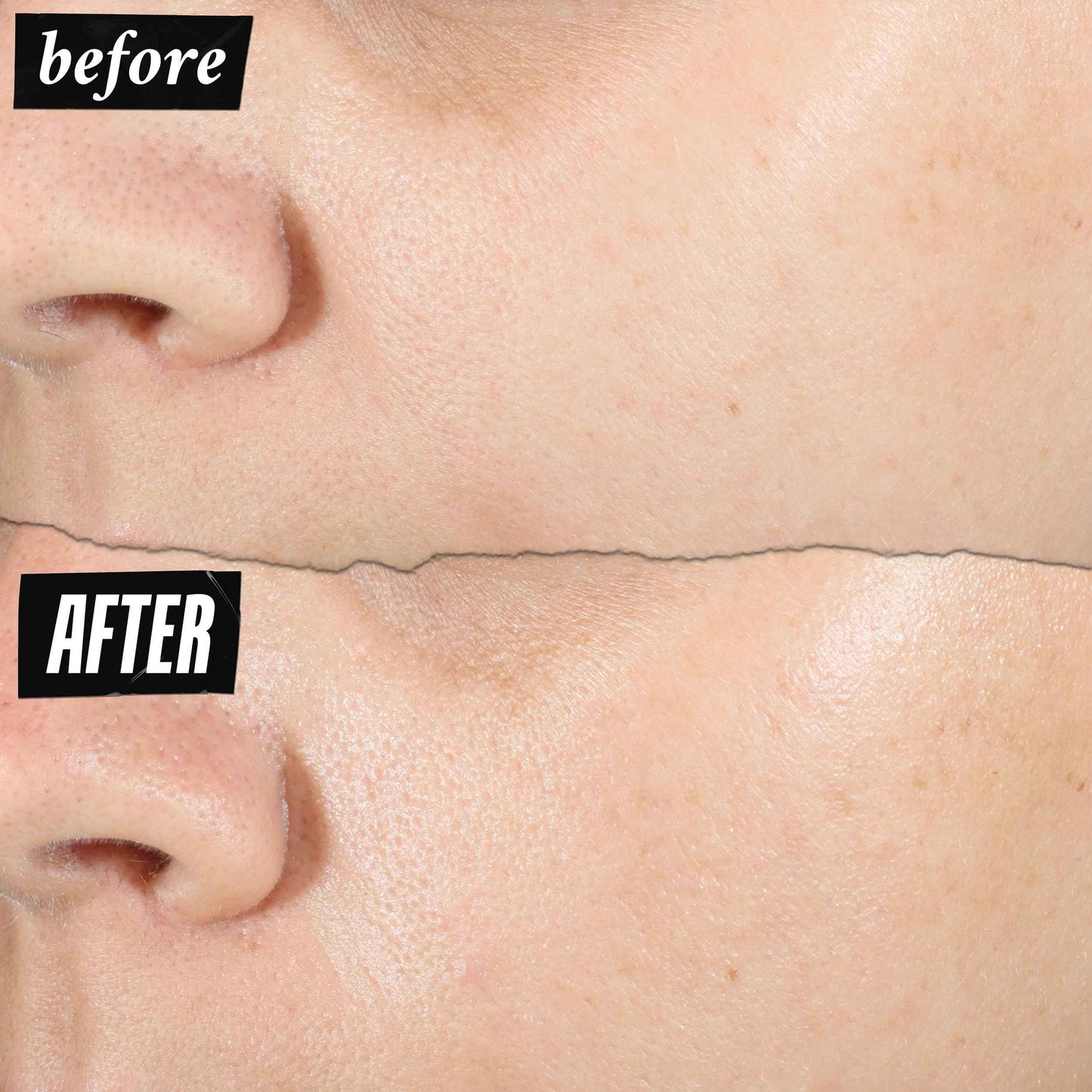 Kiehl's Ultra Pure High-Potency 1.5% Hyaluronic Acid Serum, Concentrated Face Serum for Dry Skin, Instantly Boosts Hydration, Plumps Skin, All Skin Types, Fragrance-free - 1 fl oz