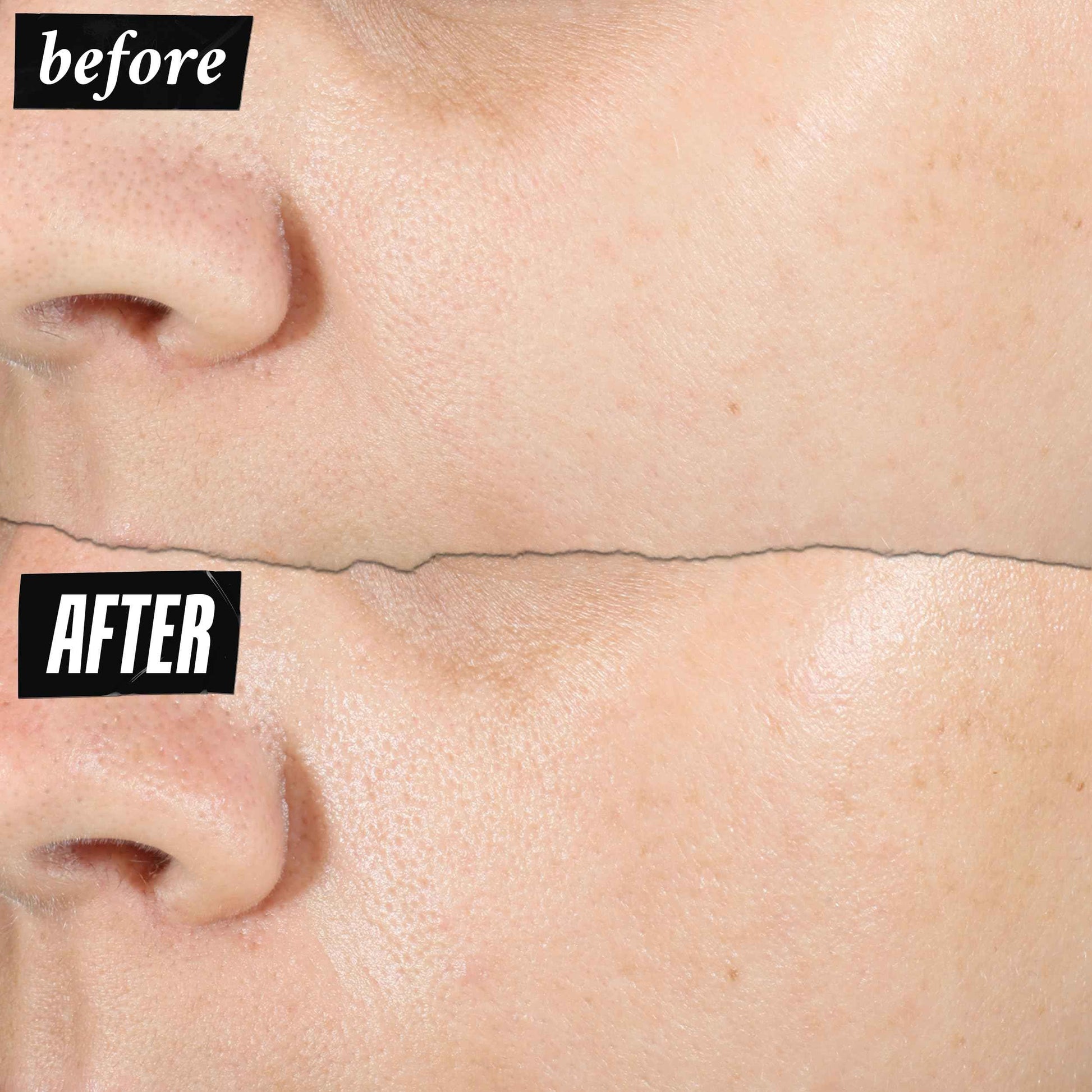 Kiehl's Ultra Pure High-Potency 1.5% Hyaluronic Acid Serum, Concentrated Face Serum for Dry Skin, Instantly Boosts Hydration, Plumps Skin, All Skin Types, Fragrance-free - 1 fl oz