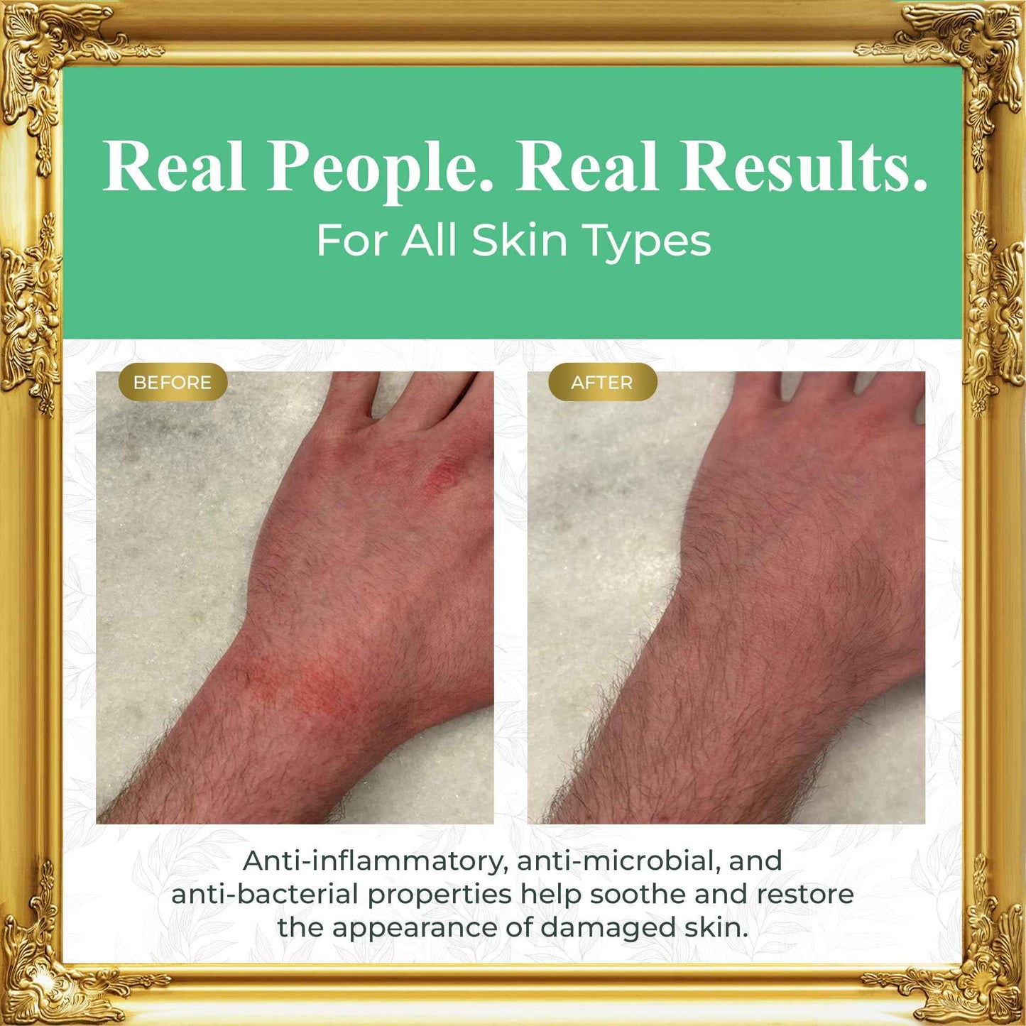 Pure Truth Beef Tallow for Skin (Unscented) - Whipped Tallow and Honey Balm, 100% Grass Fed Tallow for Face + Body Moisturizer Cream with Organic Honey, Aloe Vera, Jojoba Oil - For Men & Women 3.25 oz