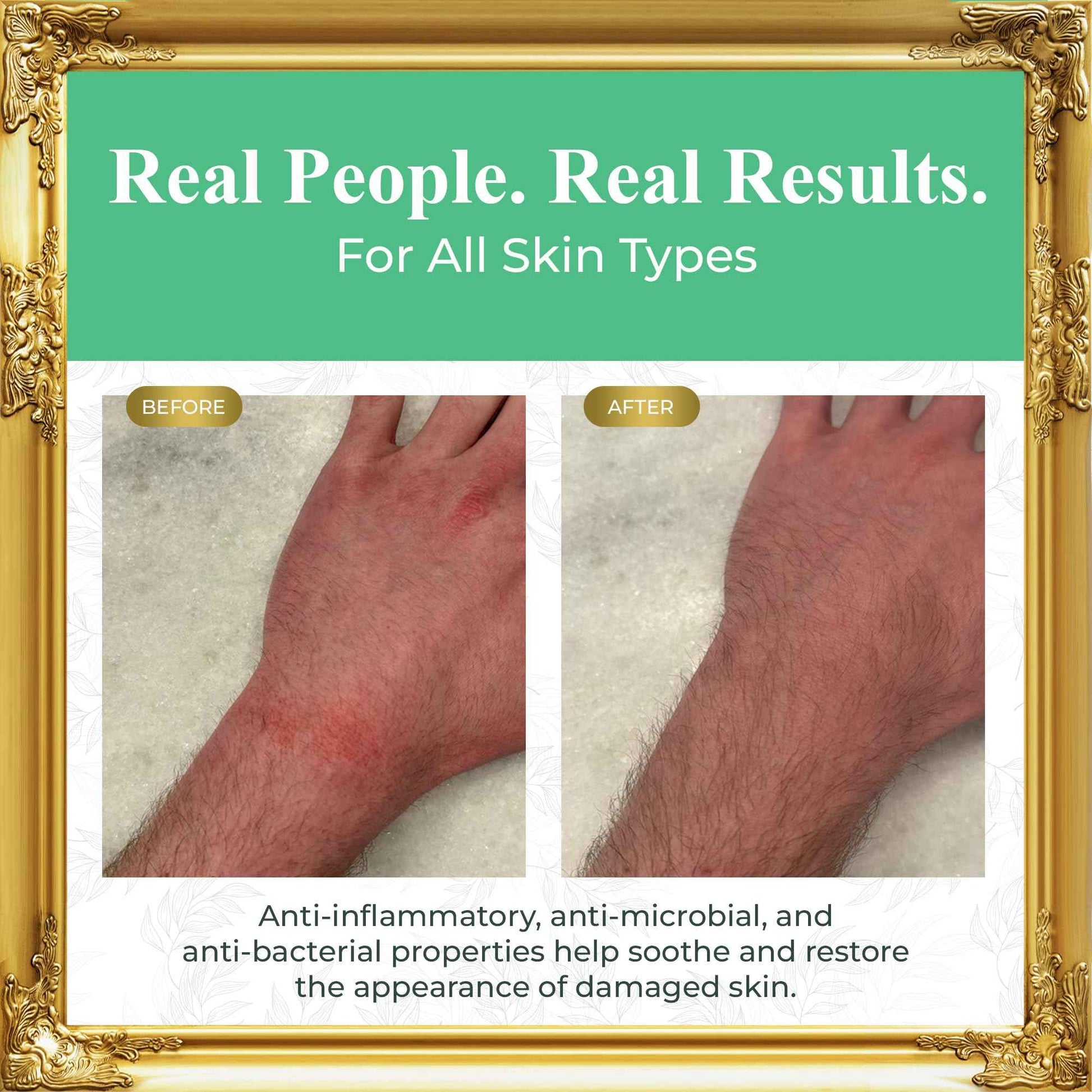 Pure Truth Beef Tallow for Skin (Unscented) - Whipped Tallow and Honey Balm, 100% Grass Fed Tallow for Face + Body Moisturizer Cream with Organic Honey, Aloe Vera, Jojoba Oil - For Men & Women 3.25 oz