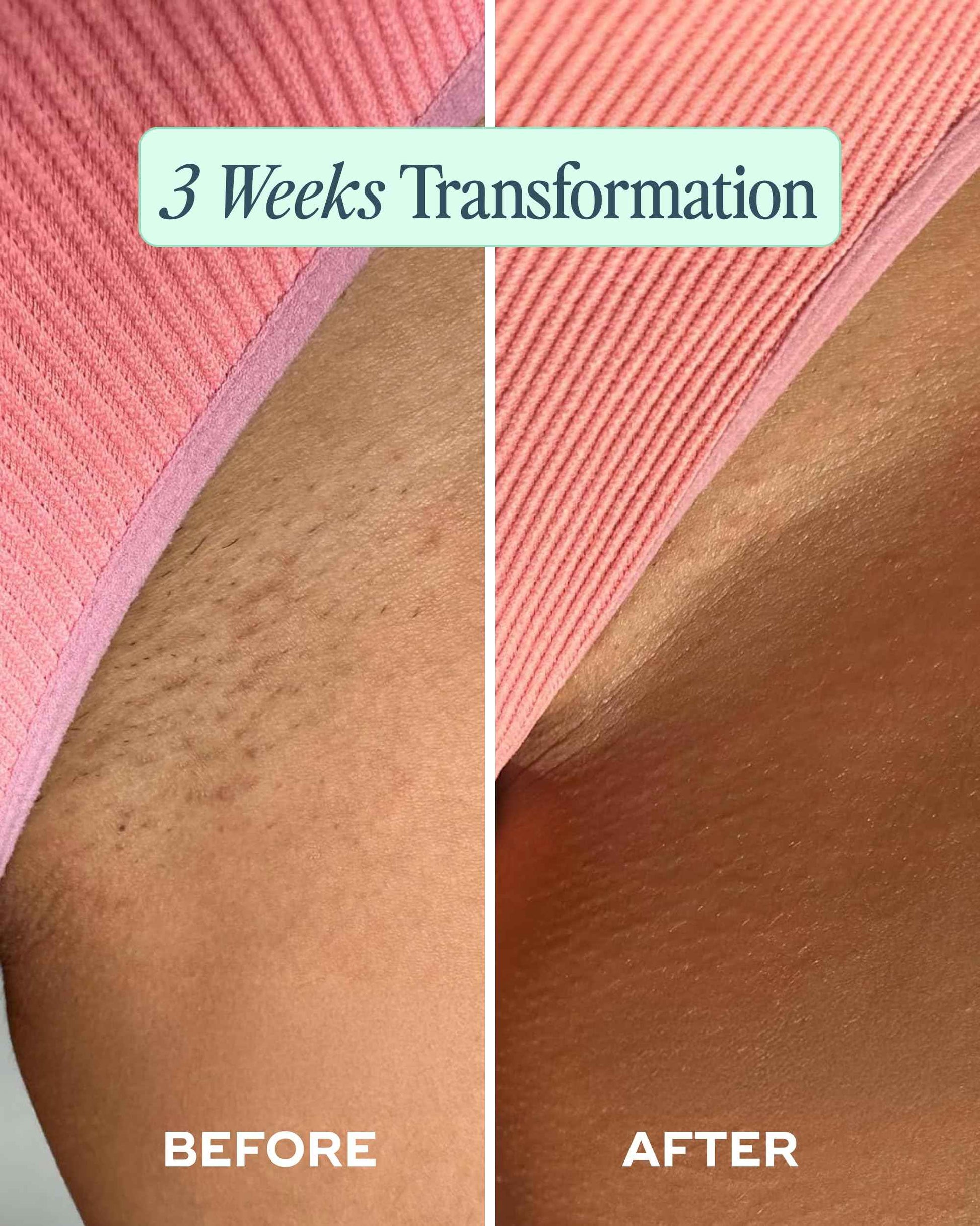 Luna Daily Ingrown Hair Oil (30ml) |Multi-Purpose Hydrating Oil |Soothes Razor Bumps, Reduces Redness, Softens Dry Skin, & Prevents Ingrown Hairs | Jojoba & Botanical Extracts for Smooth Skin