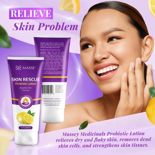 Candida Freedom Massey's Skin Rescue Probiotics Lotion - Daily lotion for Men & Women - Refreshing Lemon Scent - Non-Greasy Moisture for Smooth & Sensitive Skin - 3.4 oz