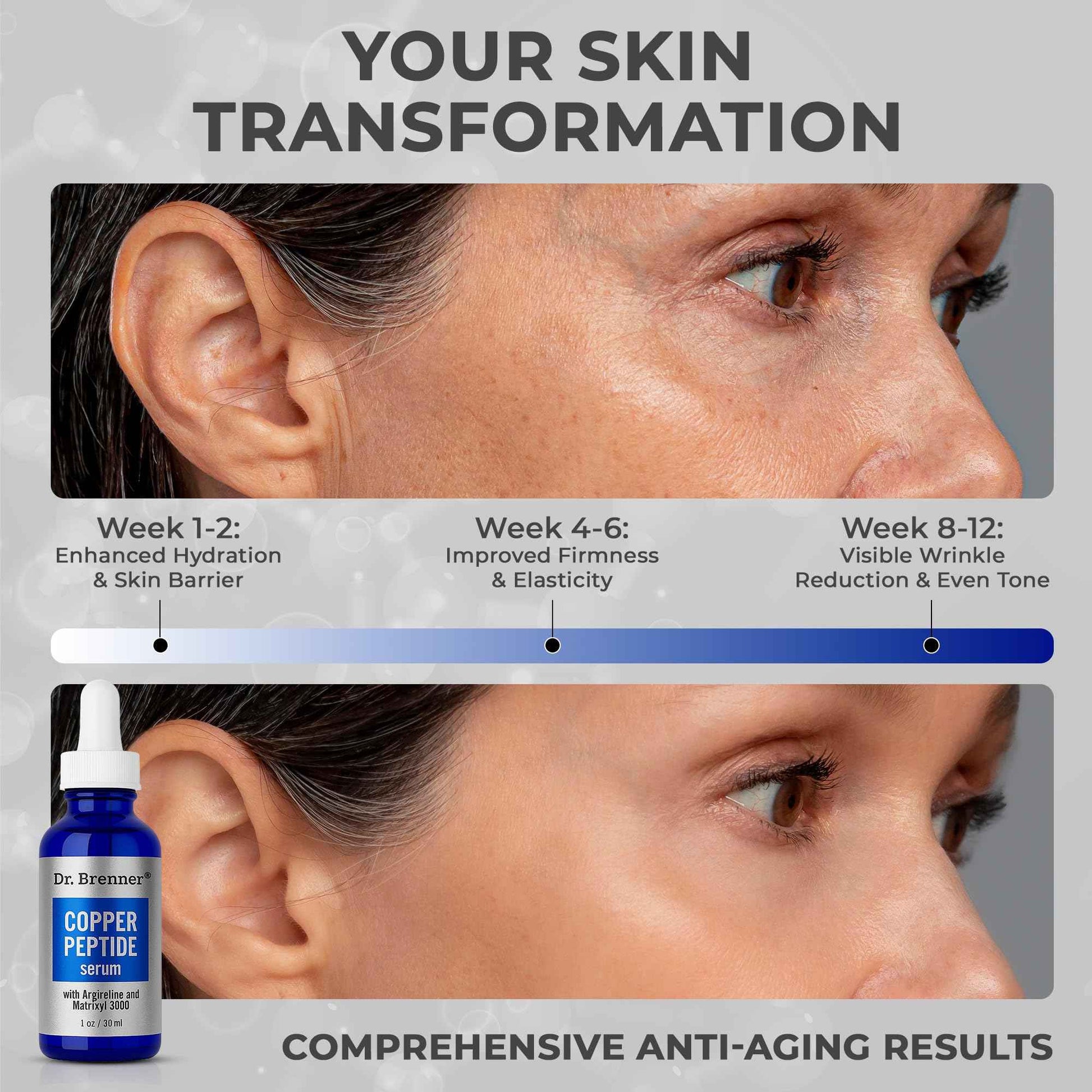 Dr. Brenner Copper Peptide Serum with GHK-Cu peptide, Argireline and Matrixyl 3000 Anti-Aging Moisturizer for Fine Lines and Skin Elasticity