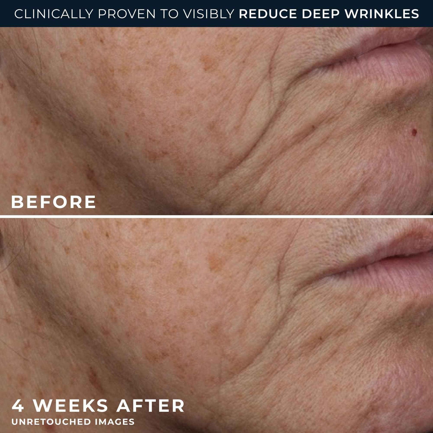 RoC Deep Wrinkle Rich Cream, Fragrance Free, Daily Anti-Aging Firming Cream For Persistent Dryness & Younger-Looking Skin For Women & Men, With Line Smoothing Eye Cream Packette, 1.7oz