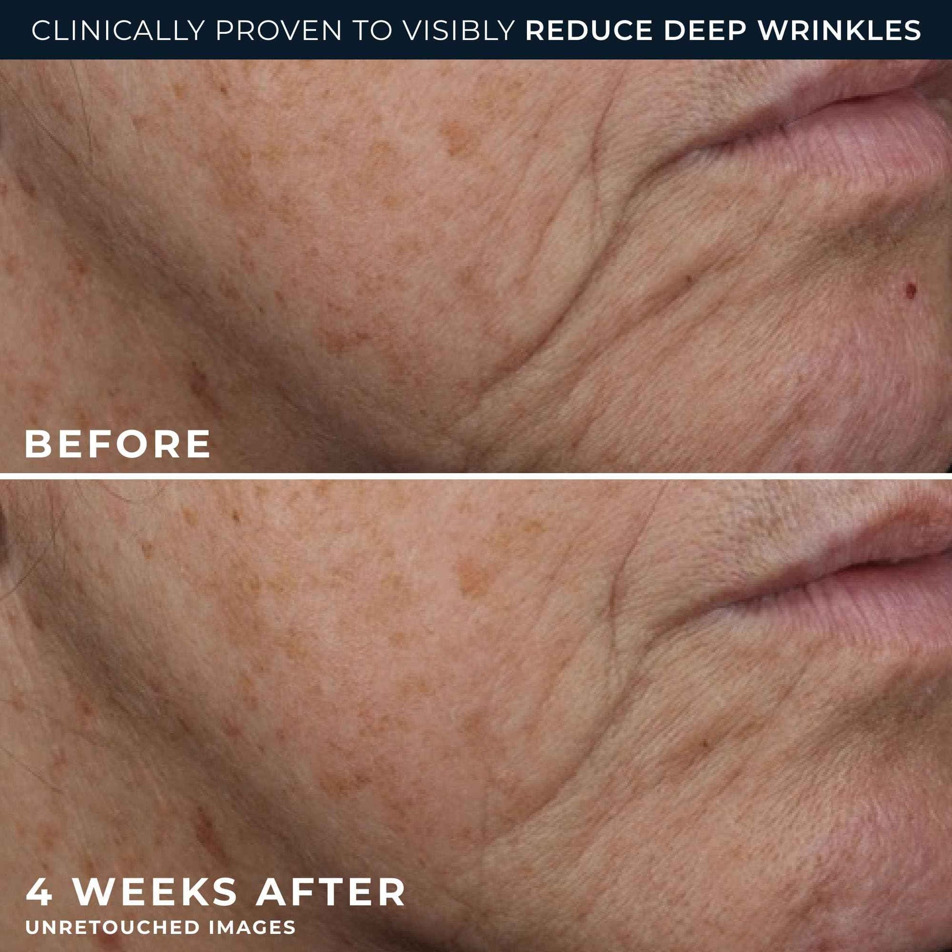 RoC Deep Wrinkle Rich Cream, Fragrance Free, Daily Anti-Aging Firming Cream For Persistent Dryness & Younger-Looking Skin For Women & Men, With Line Smoothing Eye Cream Packette, 1.7oz