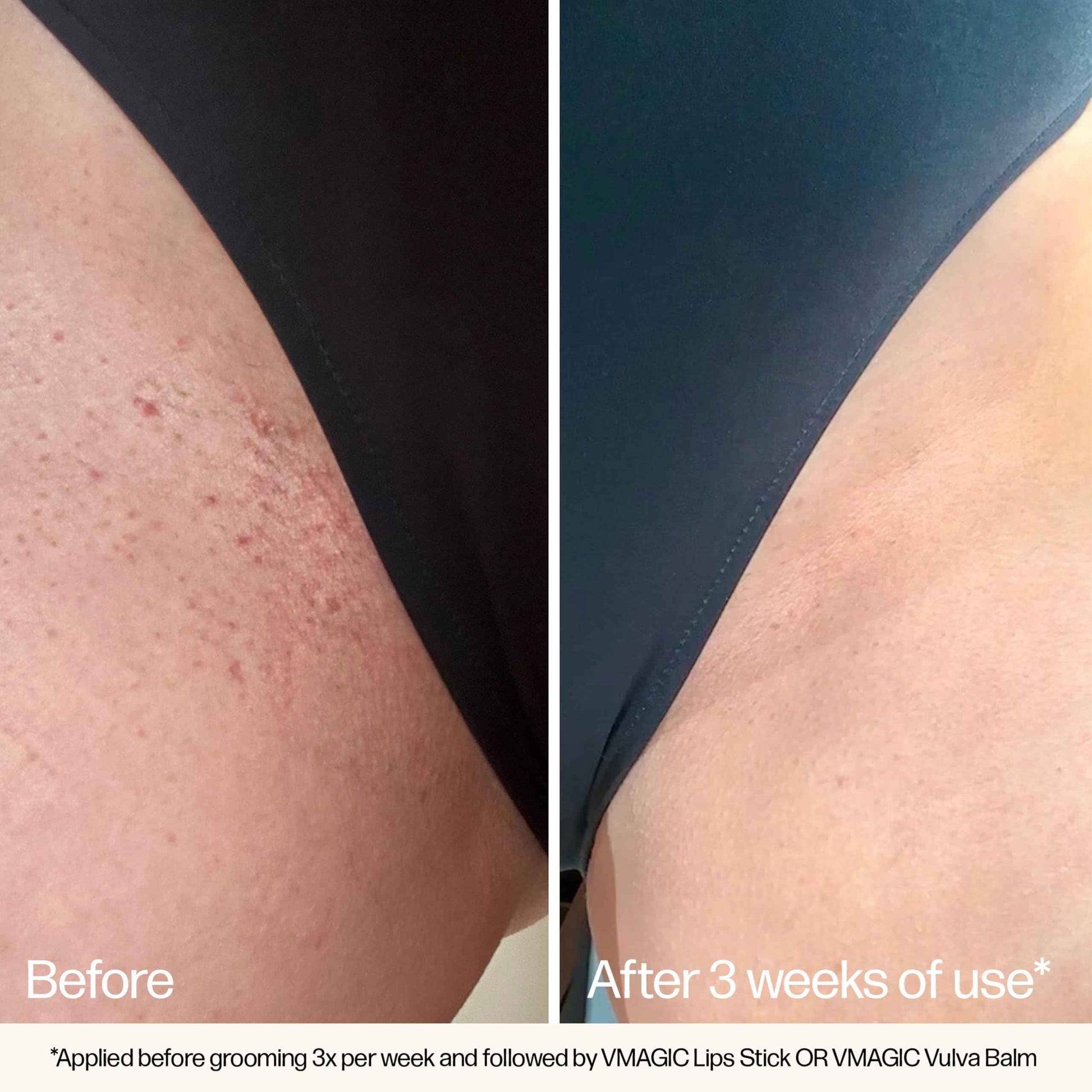 VMAGIC by Medicine Mama Grooming Polish – All-Natural Exfoliating Sugar Scrub – Preps Skin & Body for Grooming, Helps Prevent Ingrown Hairs – Brazilian Wax & Bikini Shave Aftercare – 4.5 oz