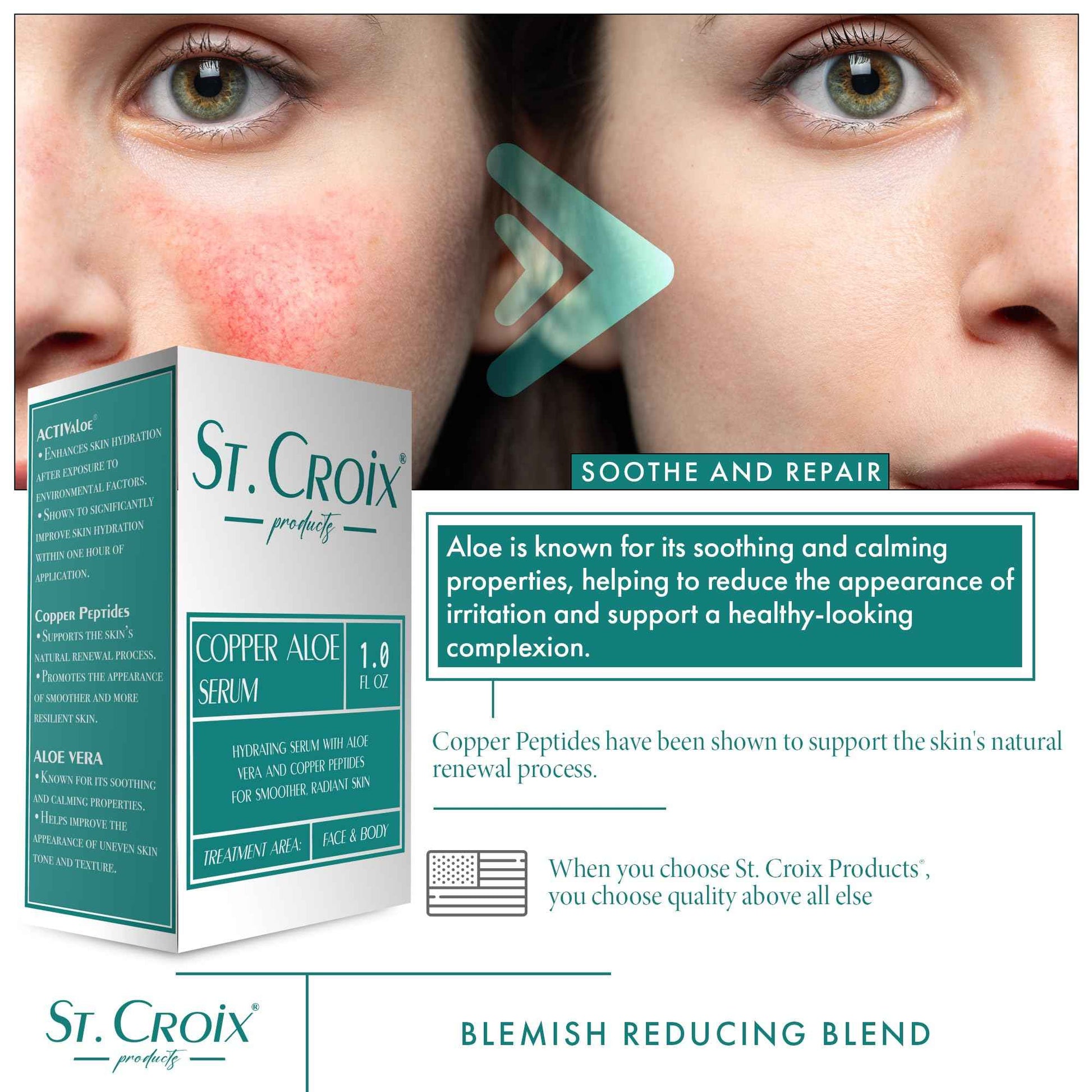 Copper Peptide & Aloe Serum – Hydrates, Firms & Soothes Skin – Highest-Grade 0.25% Copper with Pure Aloe Vera 10X-D – 1 fl oz – Peptide Blast by St. Croix Products