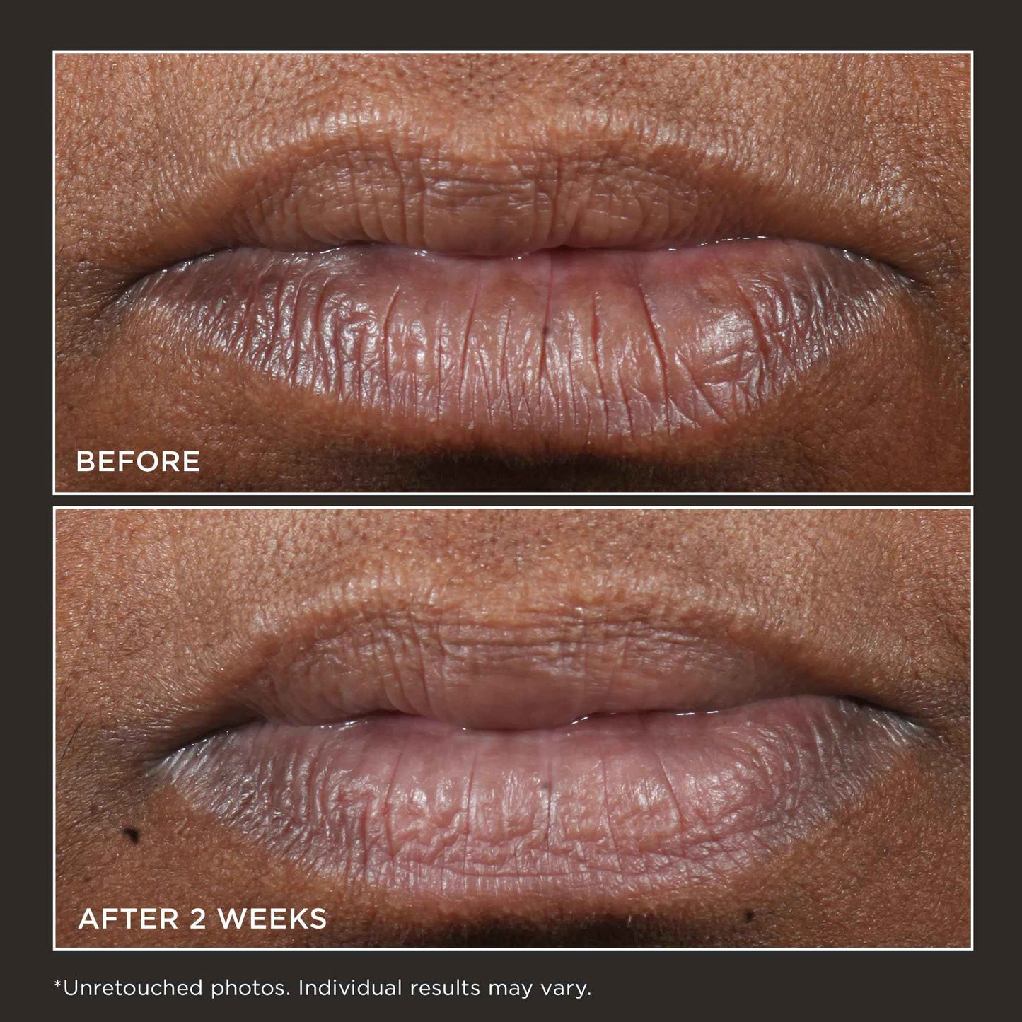 Perricone MD Cold Plasma Plus+ Lip Therapy