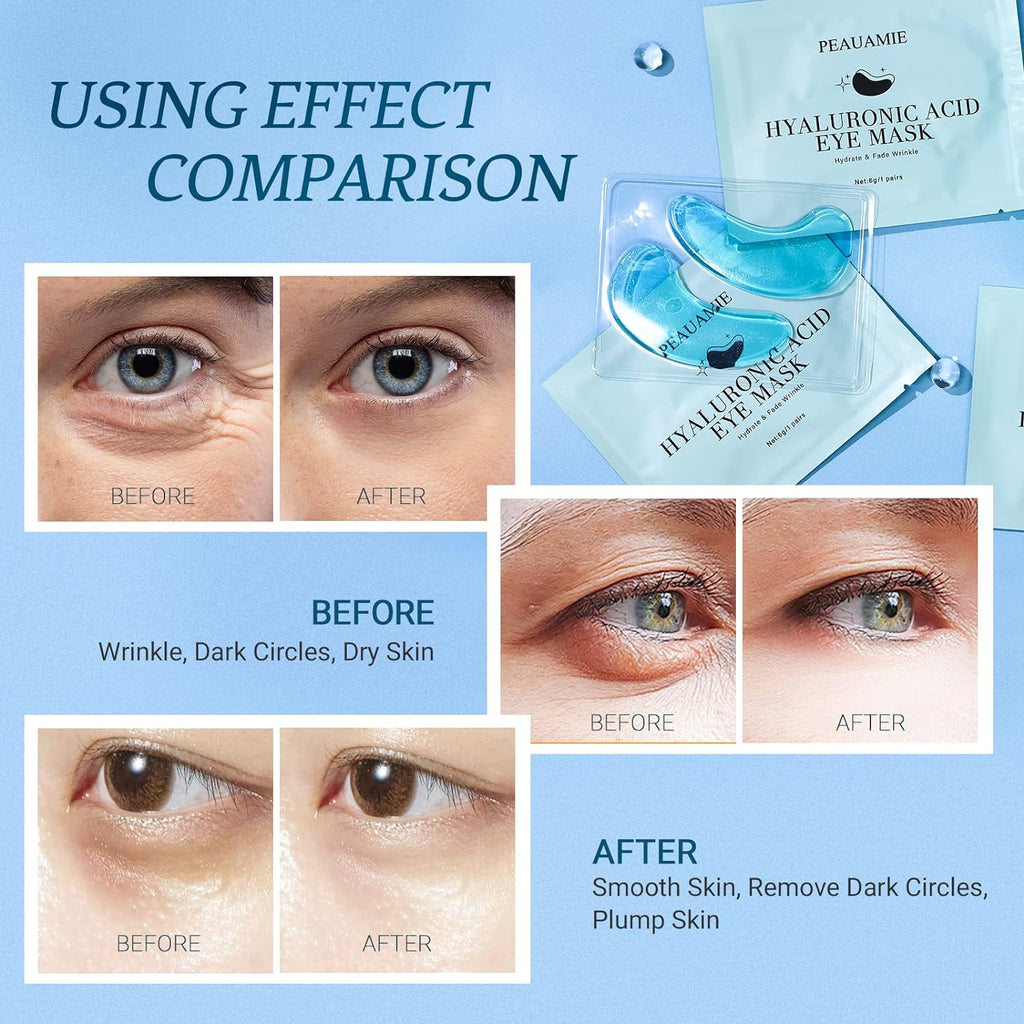 Under Eye Patches Gold and Hyaluronic Acid for puffy eyes,Rose Eye Masks for Dark Circles and Puffiness skin care Smooth Wrinkles products 30 Pairs