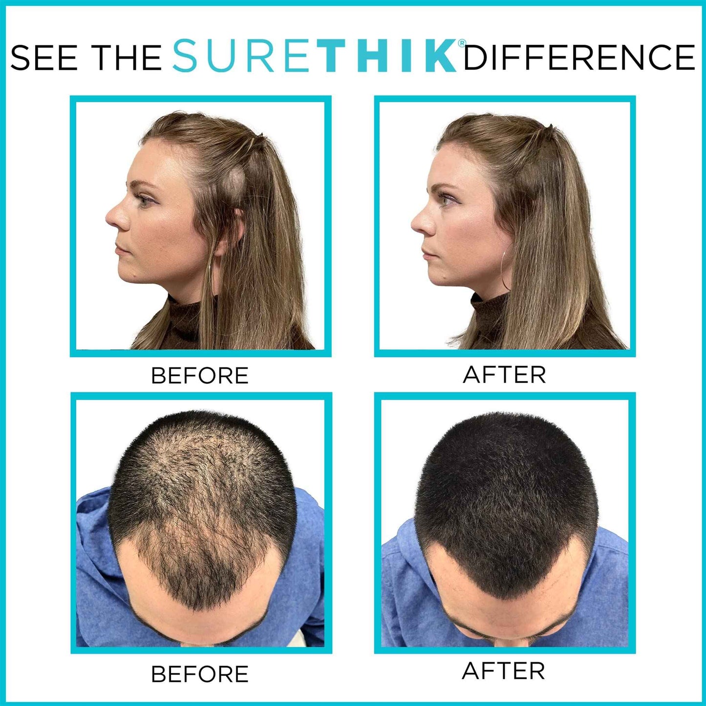 SureThik 15g Hair Thickening Fiber (Medium Brown) and Holding Spray (3.4oz) Bundle