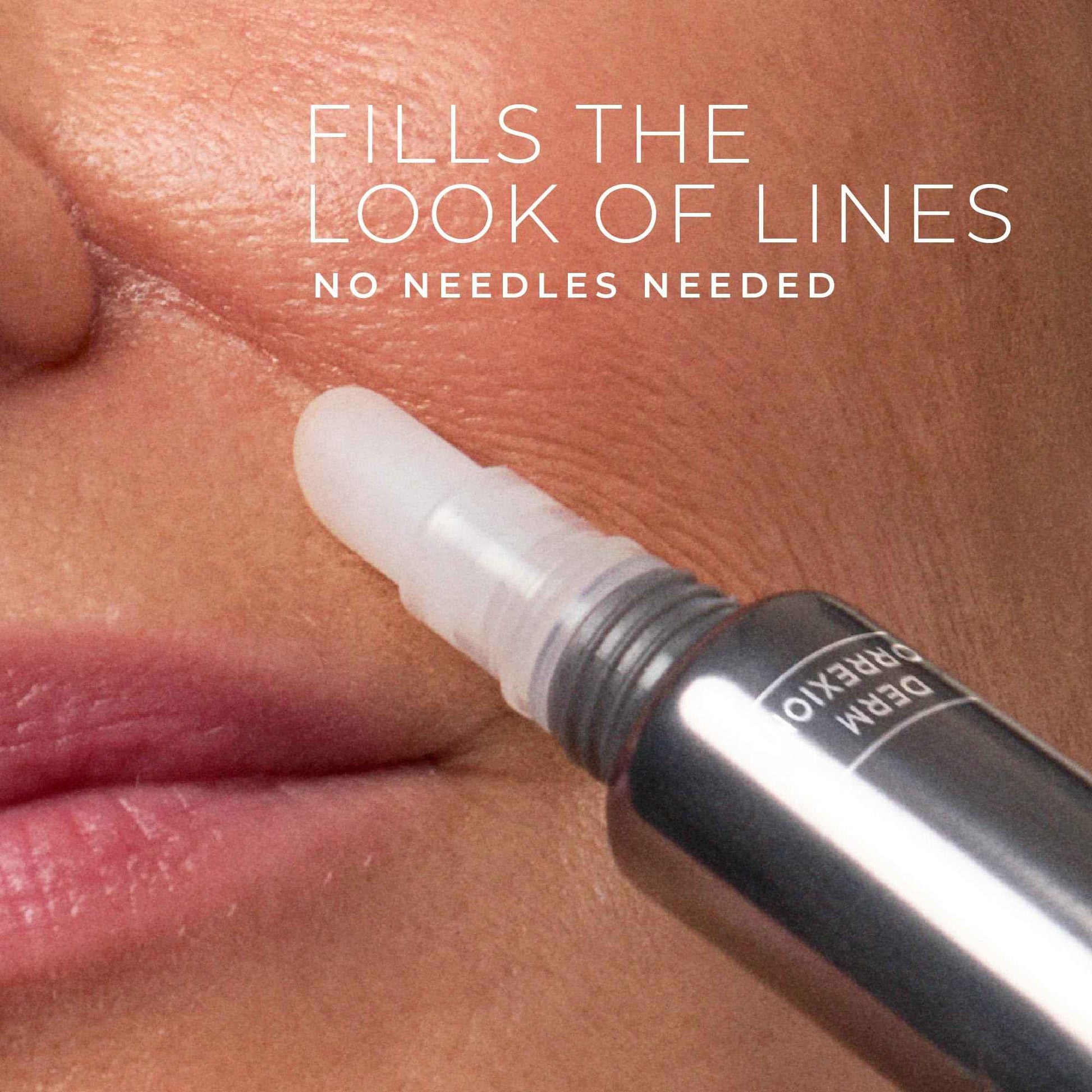 RoC Derm Correxion Fill + Treat Advanced Retinol Serum, Wrinkle Filler Treatment with Hyaluronic Acid for Crow's Feet, 11 Wrinkles, & Laugh Lines, (.5 fl oz) with Retinol Packette (Packaging May Vary)