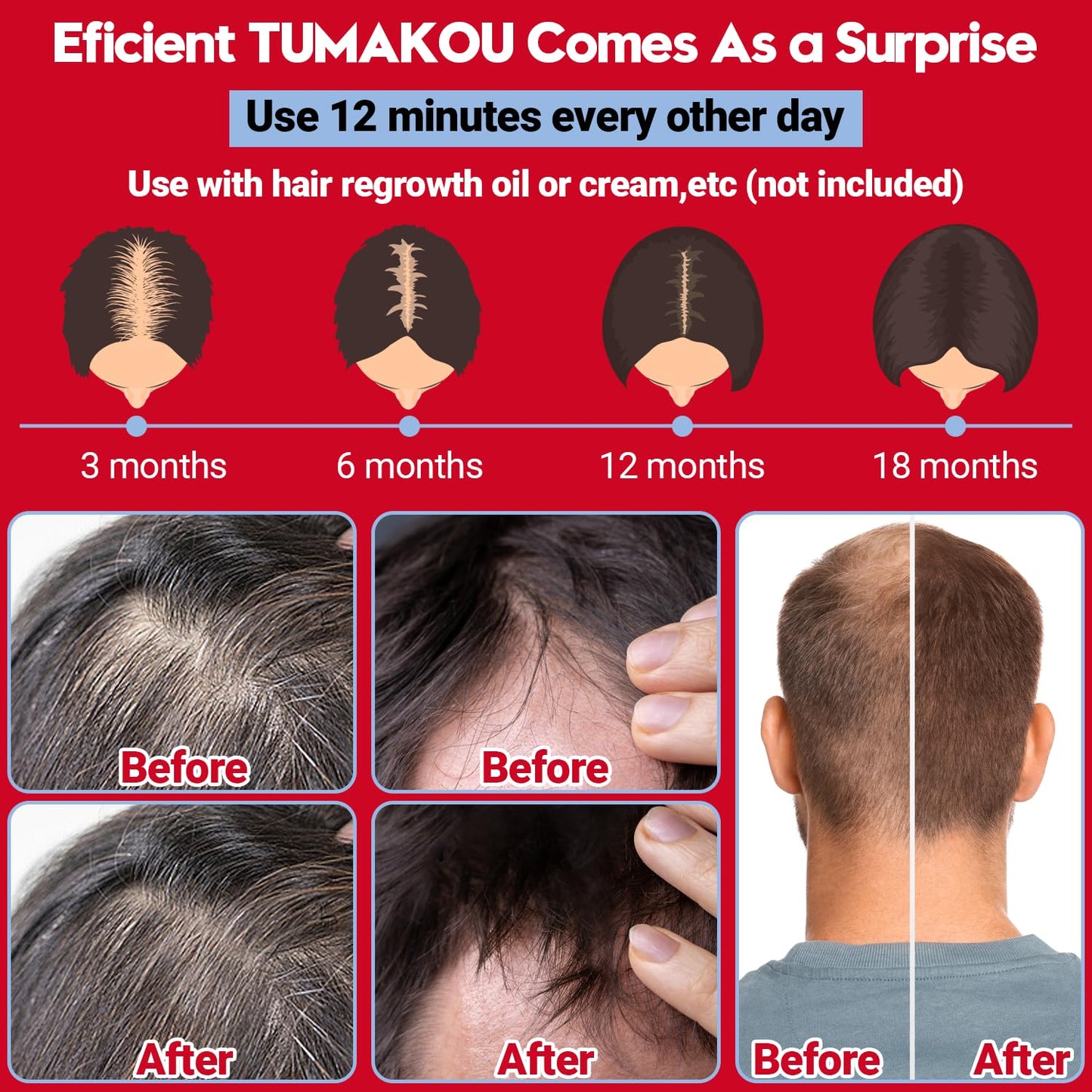 Laser Hair Growth Cap - FDA Cleared | TUMAKOU Professional Hair Growth Device - Red Light Therapy Laser Cap for Alopecia, Hair Regrowth - Hair Growth Products - Hair Loss Treatments for Men & Women