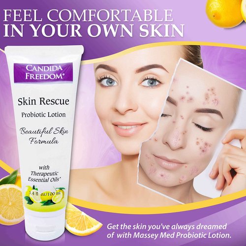 Candida Freedom Massey's Skin Rescue Probiotics Lotion - Daily lotion for Men & Women - Refreshing Lemon Scent - Non-Greasy Moisture for Smooth & Sensitive Skin - 3.4 oz