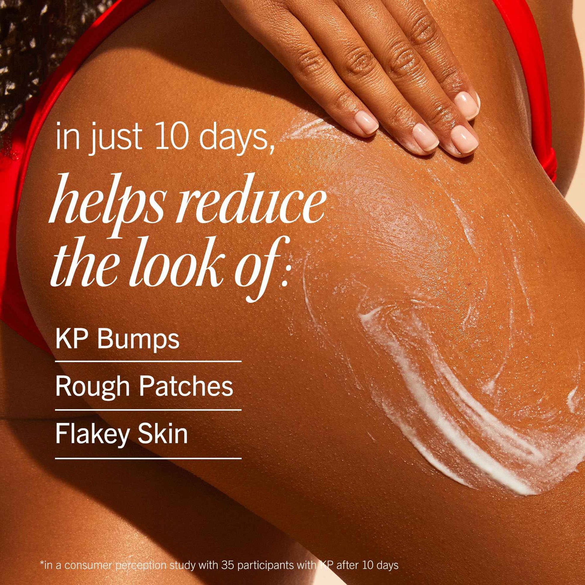 First Aid Beauty - KP Smoothing + Brightening Body Lotion with 10% AHA, Lactic Acid, Urea + Colloidal Oatmeal, Exfoliate & Moisturize, Banish Keratosis Pilaris Bumps, NEW Peach Scent (6. 7 fl oz)