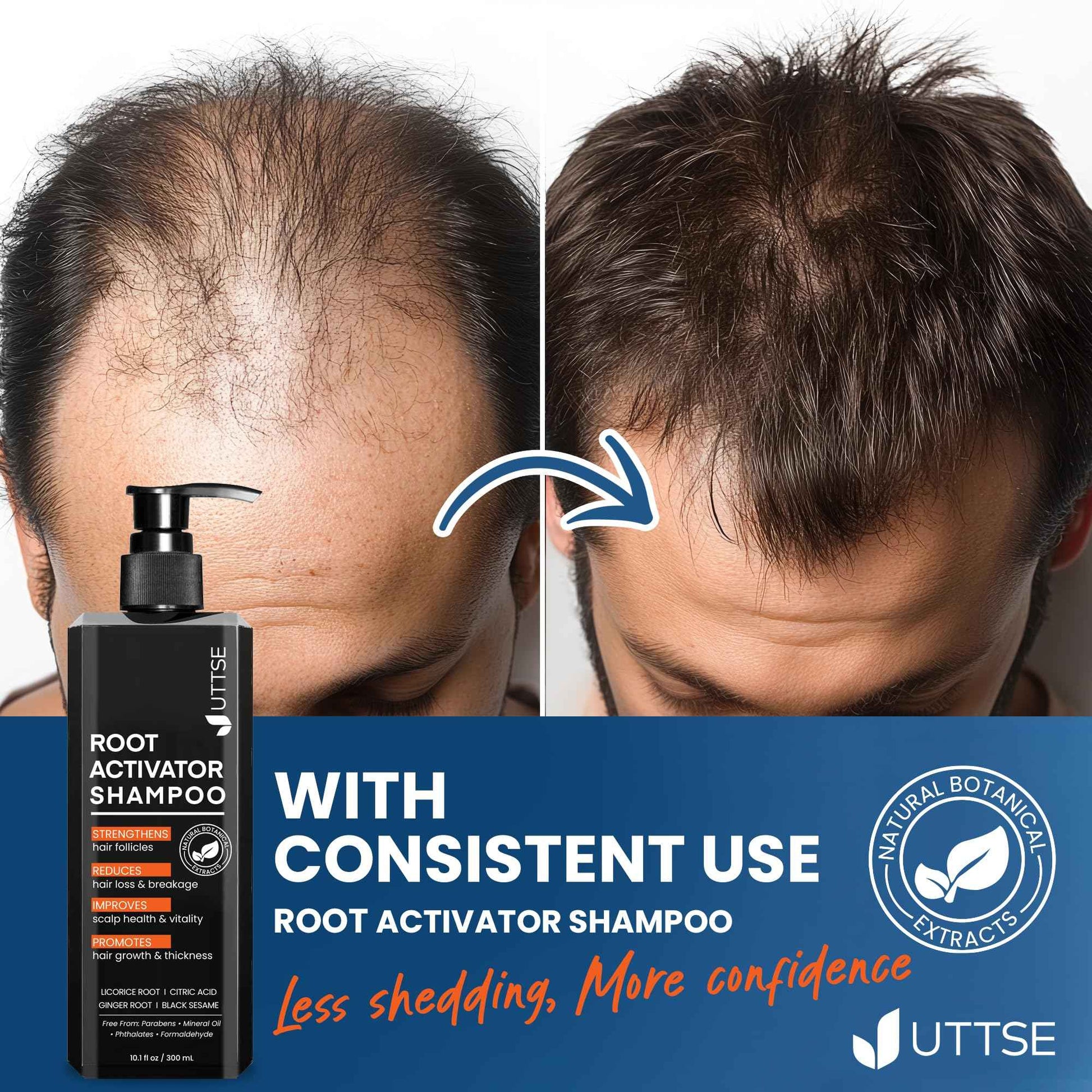 Root Activator Shampoo for Men: Hair Growth Shampoo for Hair Loss and Thinning Hair - 10.1 fl oz / 300 mL