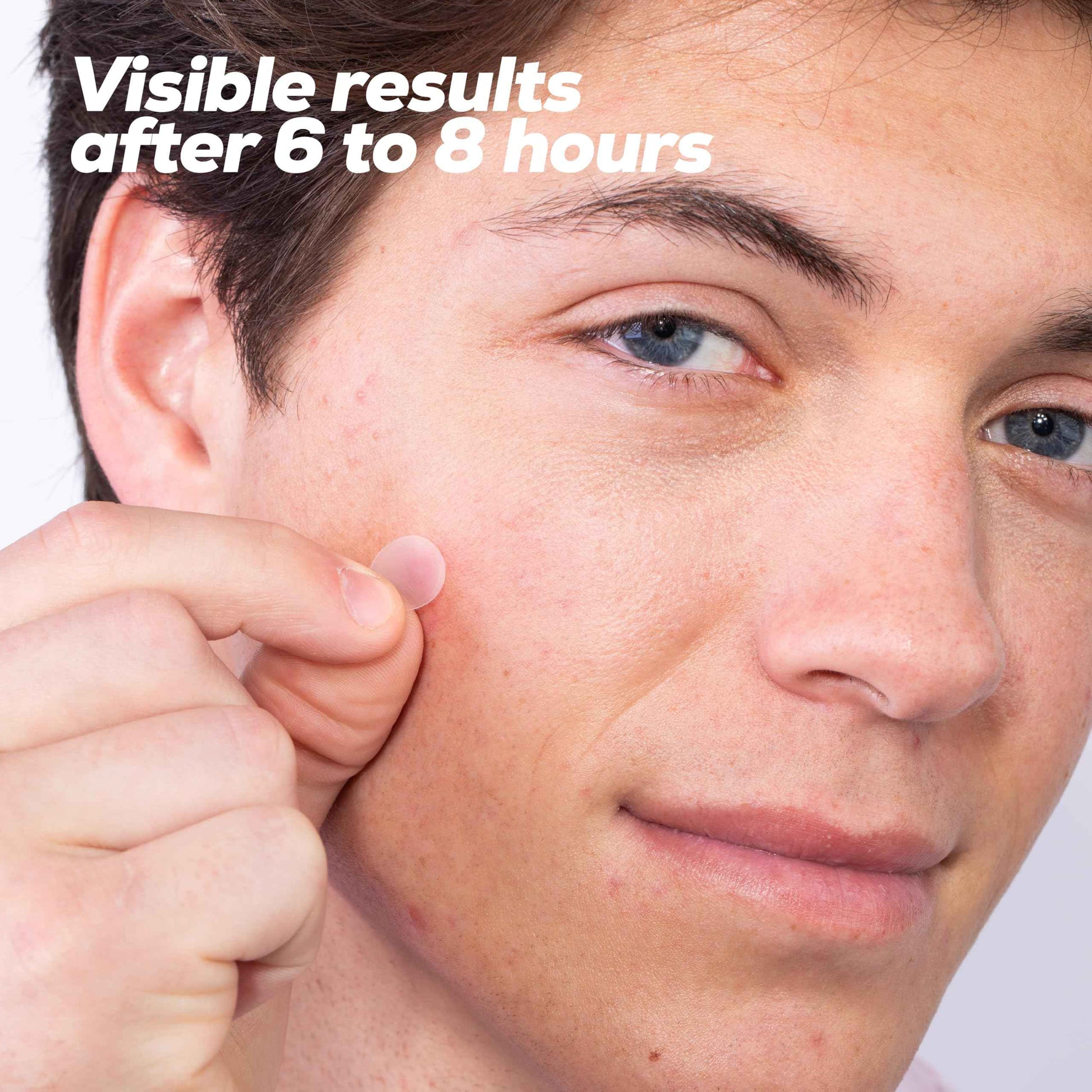 Hanhoo Extra Strength Blemish Patch Bundle, Salicylic Acid Pimple Patches, Shrinks Stubborn Pimples, Conceals Zits, Absorbs Fluid, Invisible Pimple Patches, Korean Skincare (Pack of 3, 108, Count)