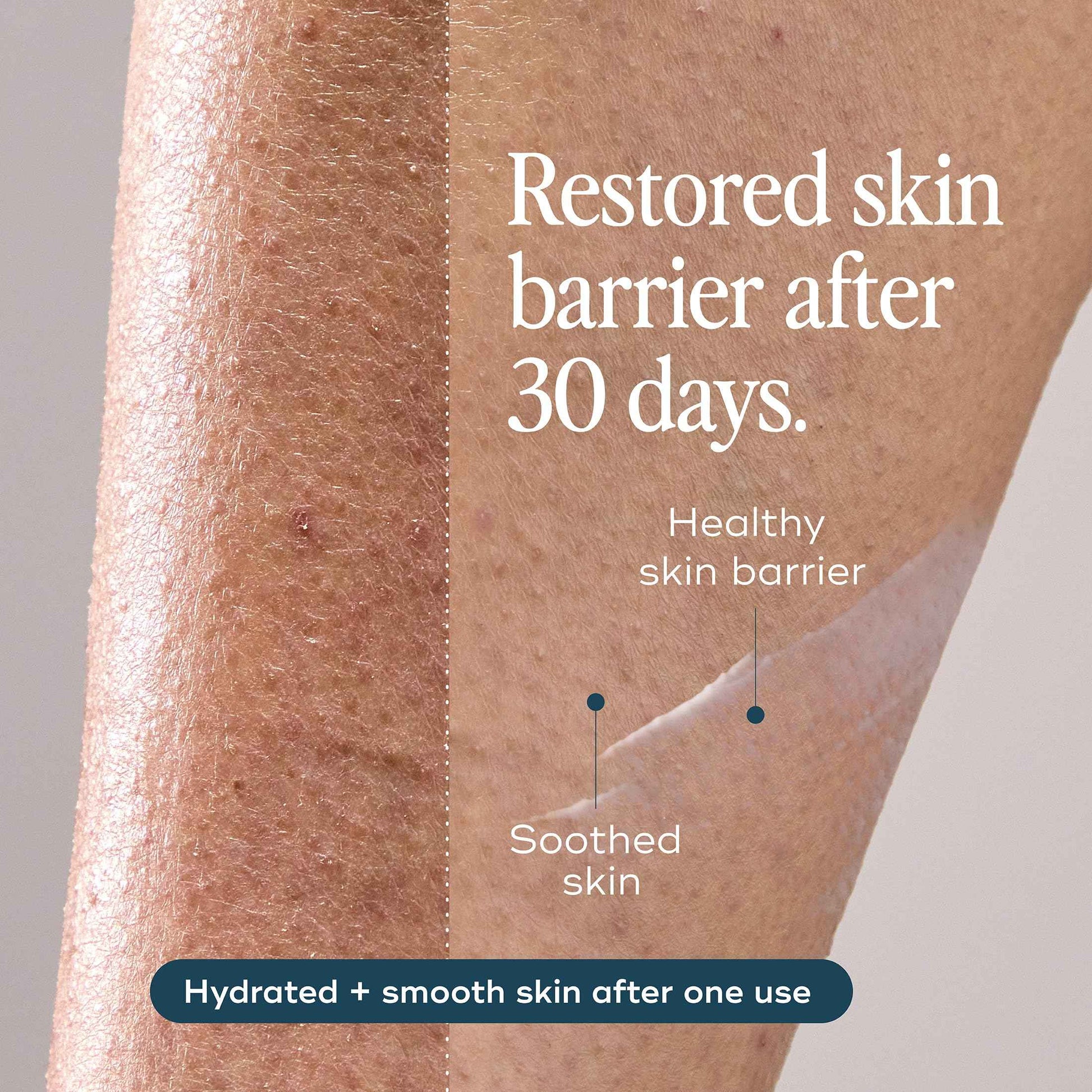 Luna Daily Body Lotion for Dry & Sensitive Skin | Hydrating, Barrier-Supporting Daily Moisturizer | With Niacinamide, Shea Butter, Prebiotics & Postbiotics | Nourishes, Firms & Soothes