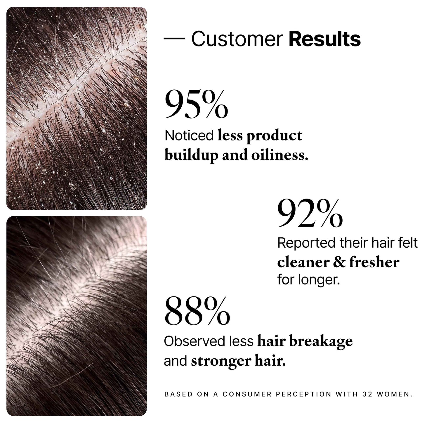 My Way Hair DNA Detox Shampoo – Deep Clarifying Formula for Product Buildup, Scalp Health Balance, and Damage Repair – Paraben, Phthalate, Sulfate, and Cruelty-Free Hair Care (8 oz)