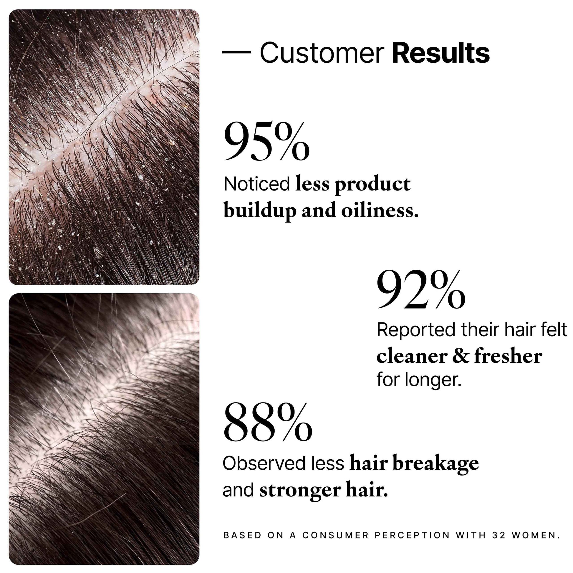 My Way Hair DNA Detox Shampoo – Deep Clarifying Formula for Product Buildup, Scalp Health Balance, and Damage Repair – Paraben, Phthalate, Sulfate, and Cruelty-Free Hair Care (8 oz)