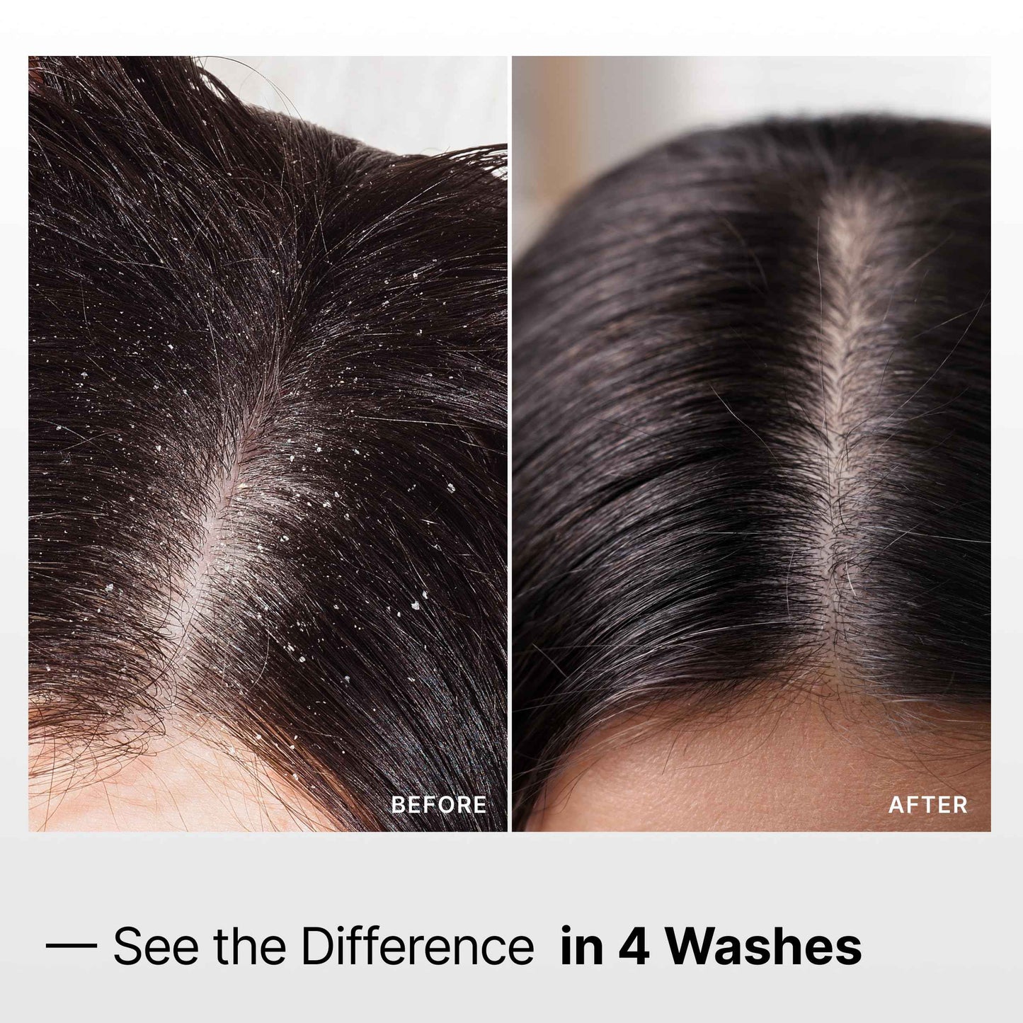 My Way Hair DNA Detox Shampoo – Deep Clarifying Formula for Product Buildup, Scalp Health Balance, and Damage Repair – Paraben, Phthalate, Sulfate, and Cruelty-Free Hair Care (8 oz)