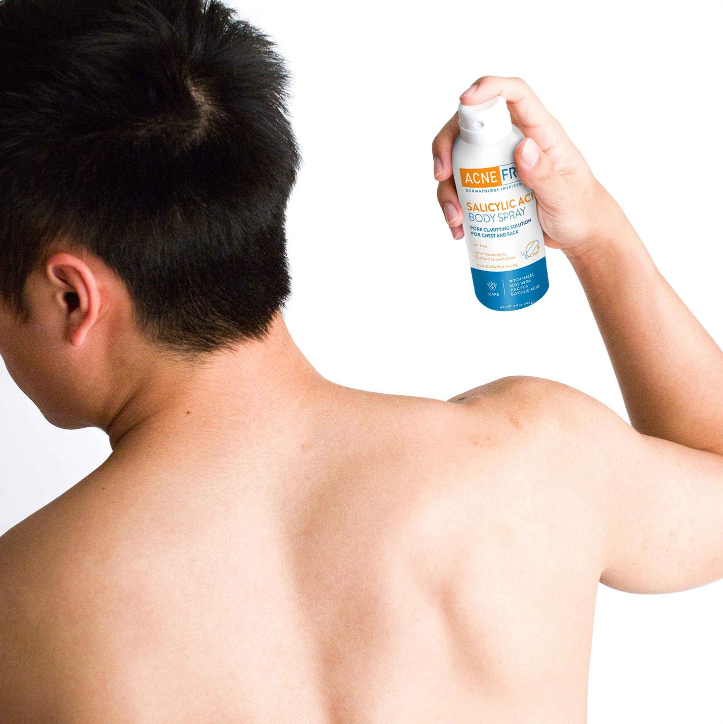 Acne Free Salicylic Acid Body Spray, Salycylic Acid, Glycolic Acid for Exfoliating, Clarify and Unclog Pores, Basic, 5 Ounce (Pack of 3)