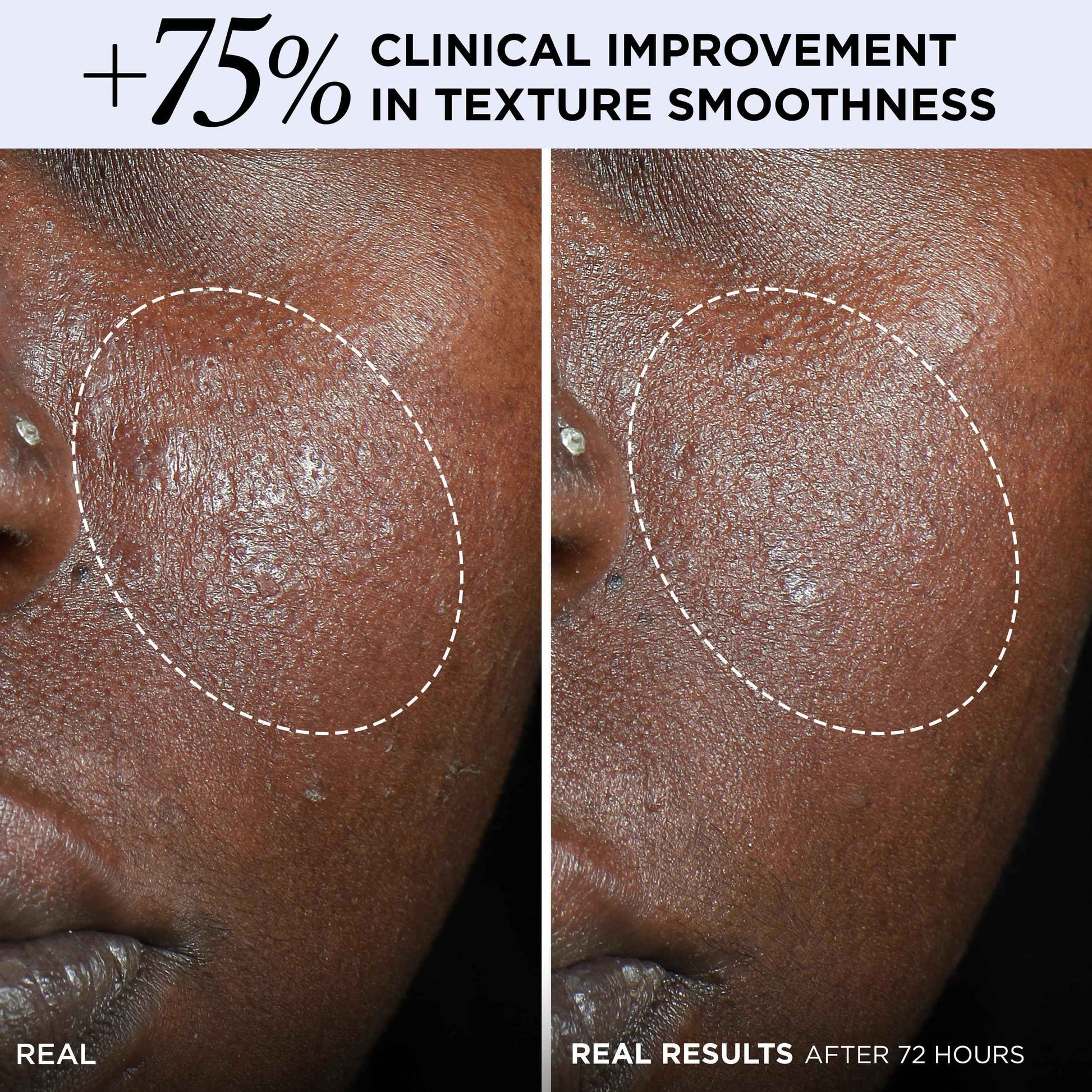 IT Cosmetics Confidence in a Cream Barrier Boost - Skin Barrier Repair Daily Face Moisturizer - Clinically Smoother, Softer Skin After 1 Use - Fragrance-Free, 100HR Hydration with Ceramide - 2 Fl Oz